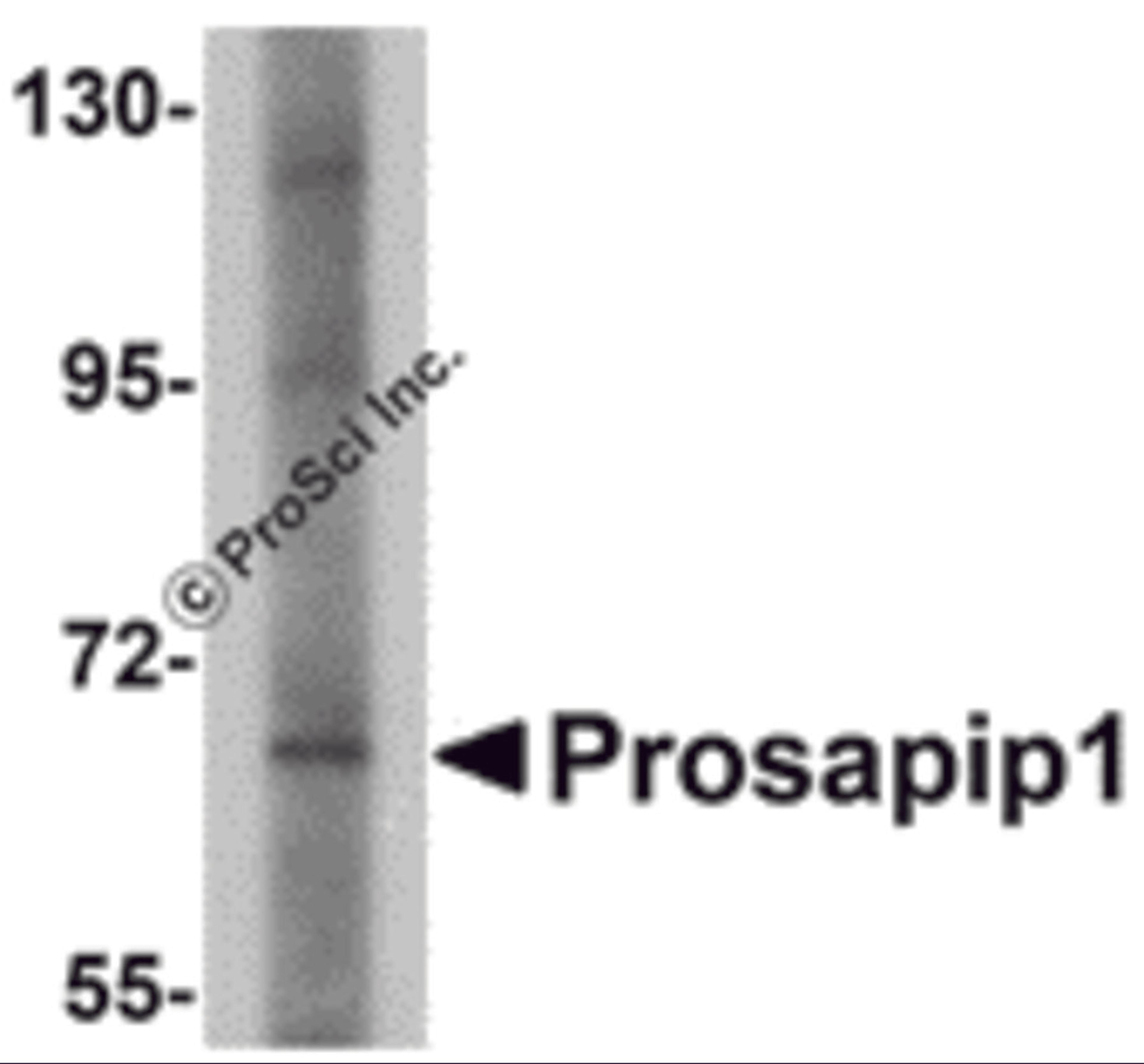 Western blot analysis of Prosapip1 in SK-N-SH cell lysate with Prosapip1 antibody at 1 &#956;g/mL. 