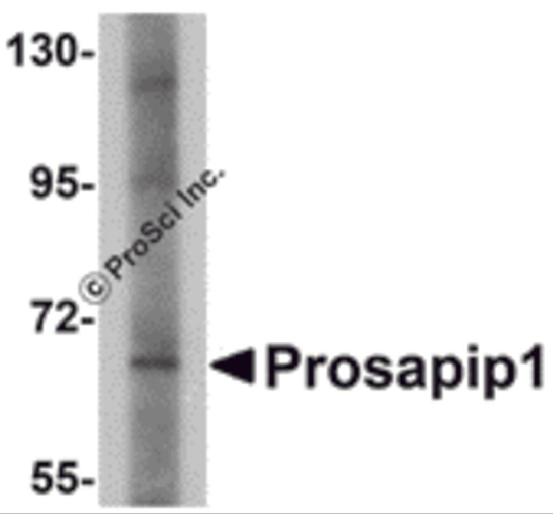 Western blot analysis of Prosapip1 in SK-N-SH cell lysate with Prosapip1 antibody at 1 μg/mL.