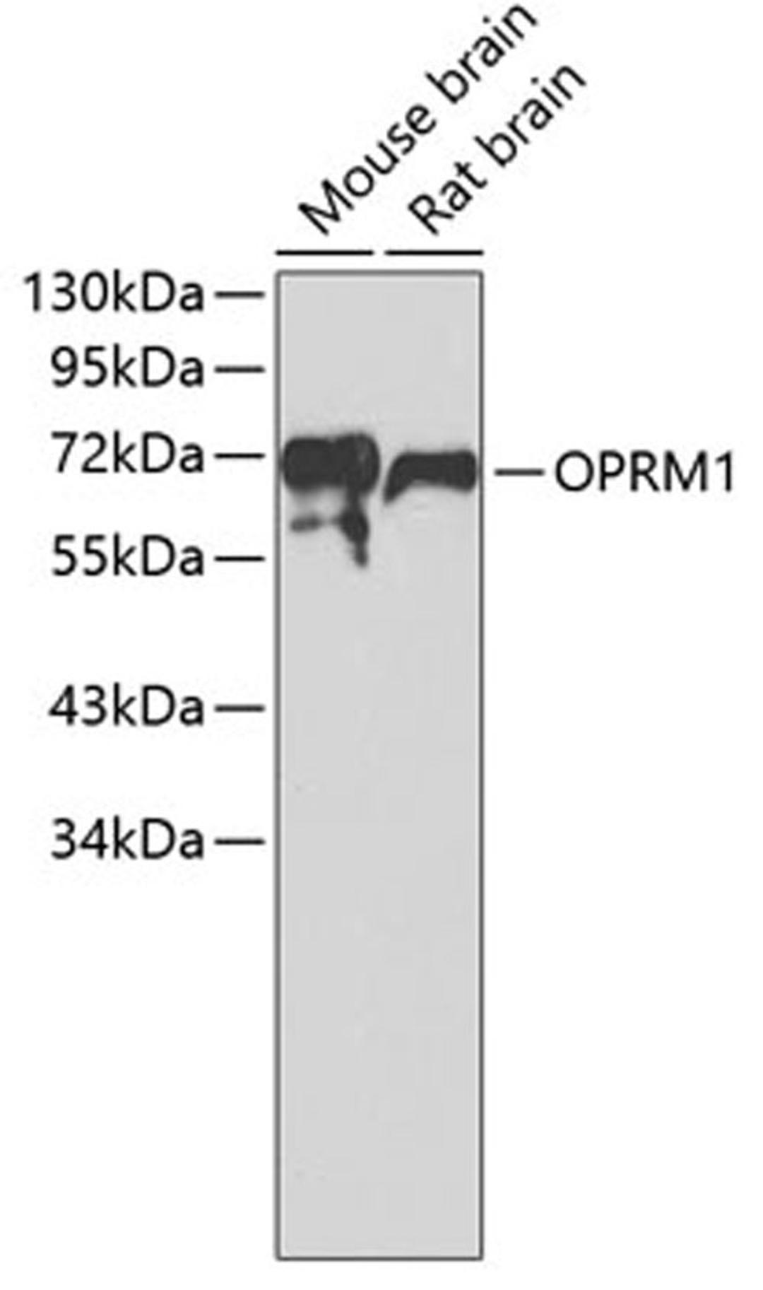 Western blot - OPRM1 antibody (A7264)