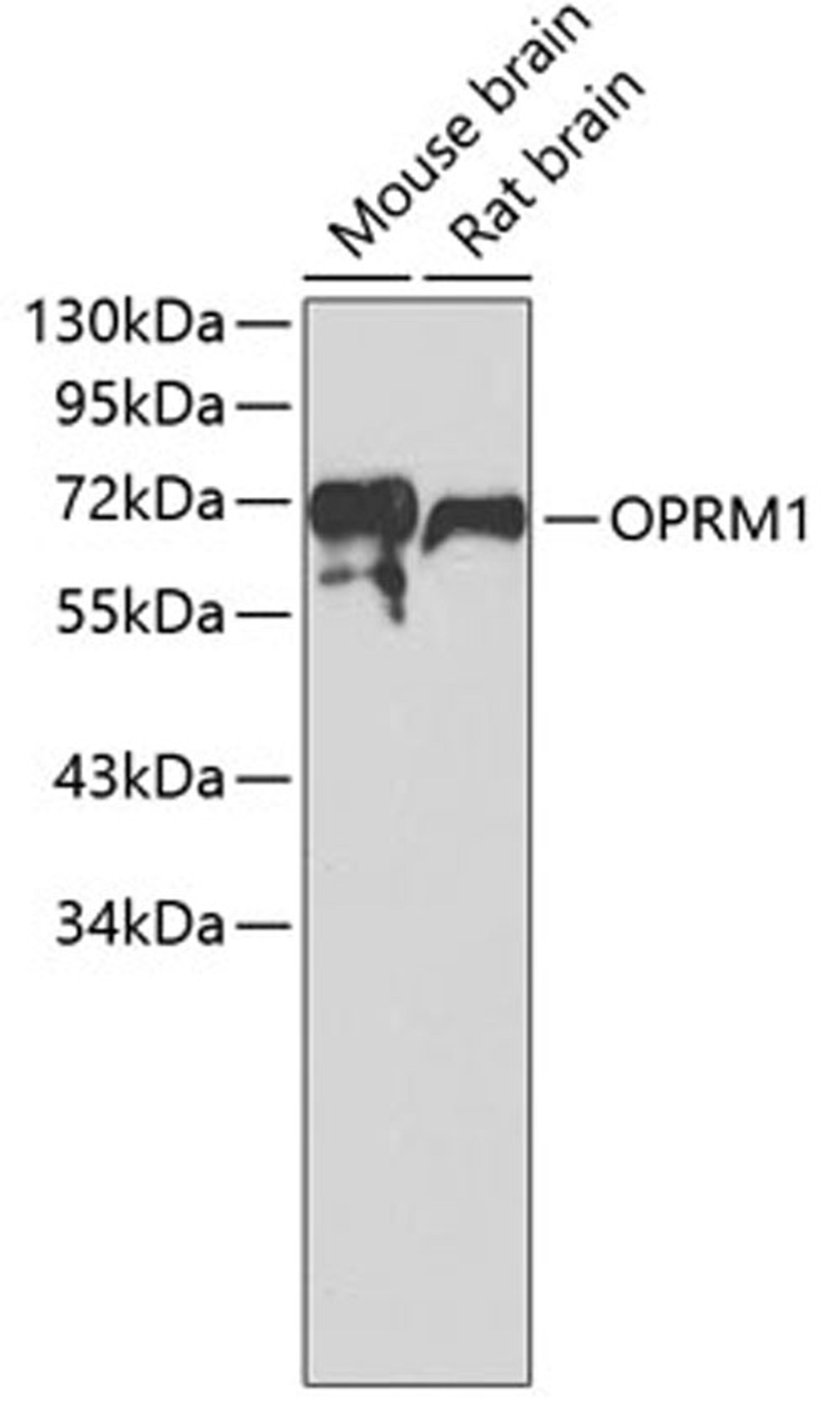 Western blot - OPRM1 antibody (A7264)