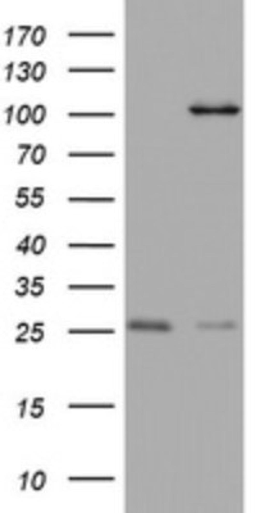 Immunohistochemistry: C3orf15 Antibody (6G1) [NBP2-45449] - Analysis of HEK293T cells were transfected with the pCMV6-ENTRY control (Left lane) or pCMV6-ENTRY C3orf15.