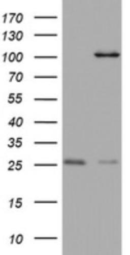 Immunohistochemistry: C3orf15 Antibody (6G1) [NBP2-45449] - Analysis of HEK293T cells were transfected with the pCMV6-ENTRY control (Left lane) or pCMV6-ENTRY C3orf15.