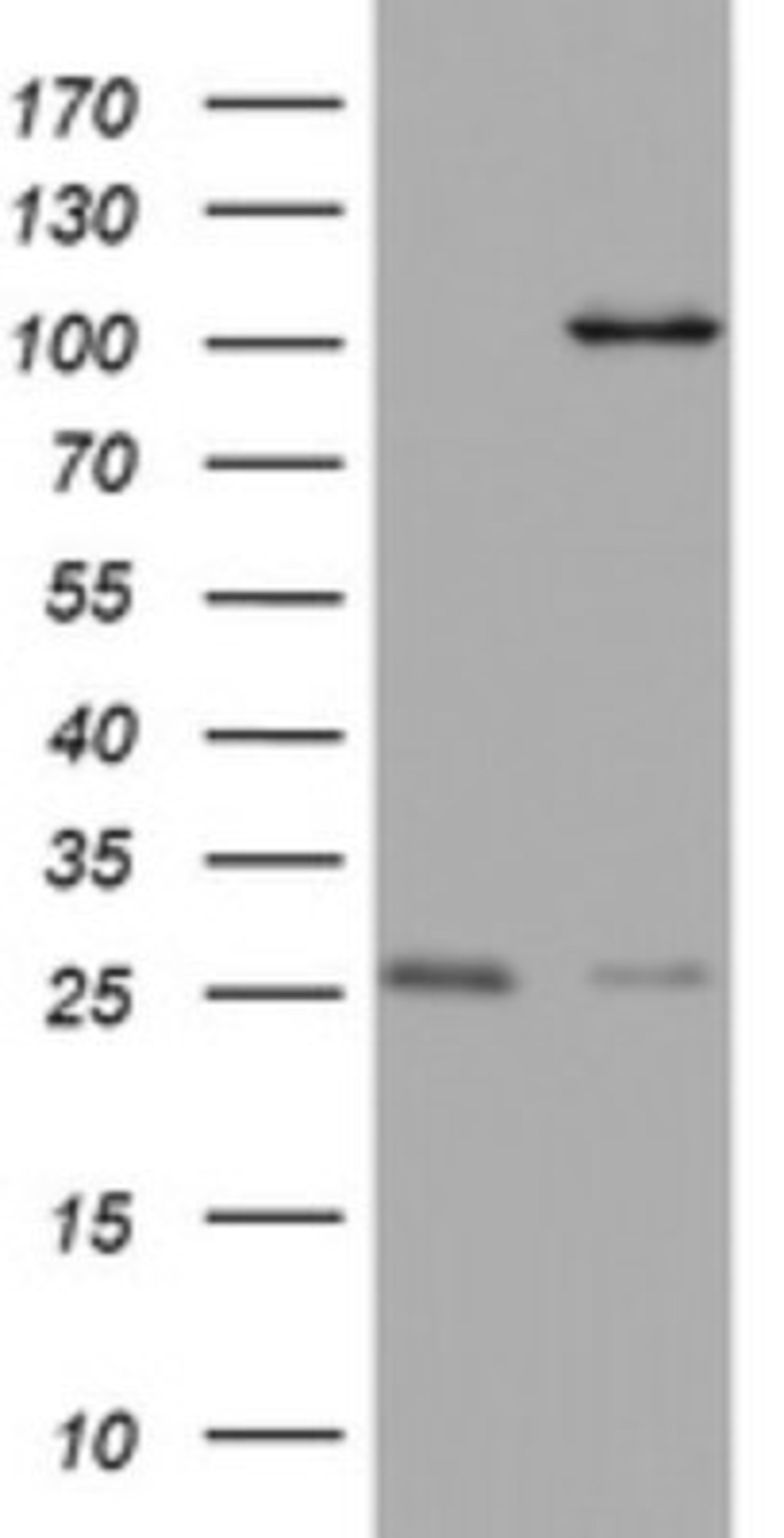 Immunohistochemistry: C3orf15 Antibody (6G1) [NBP2-45449] - Analysis of HEK293T cells were transfected with the pCMV6-ENTRY control (Left lane) or pCMV6-ENTRY C3orf15.