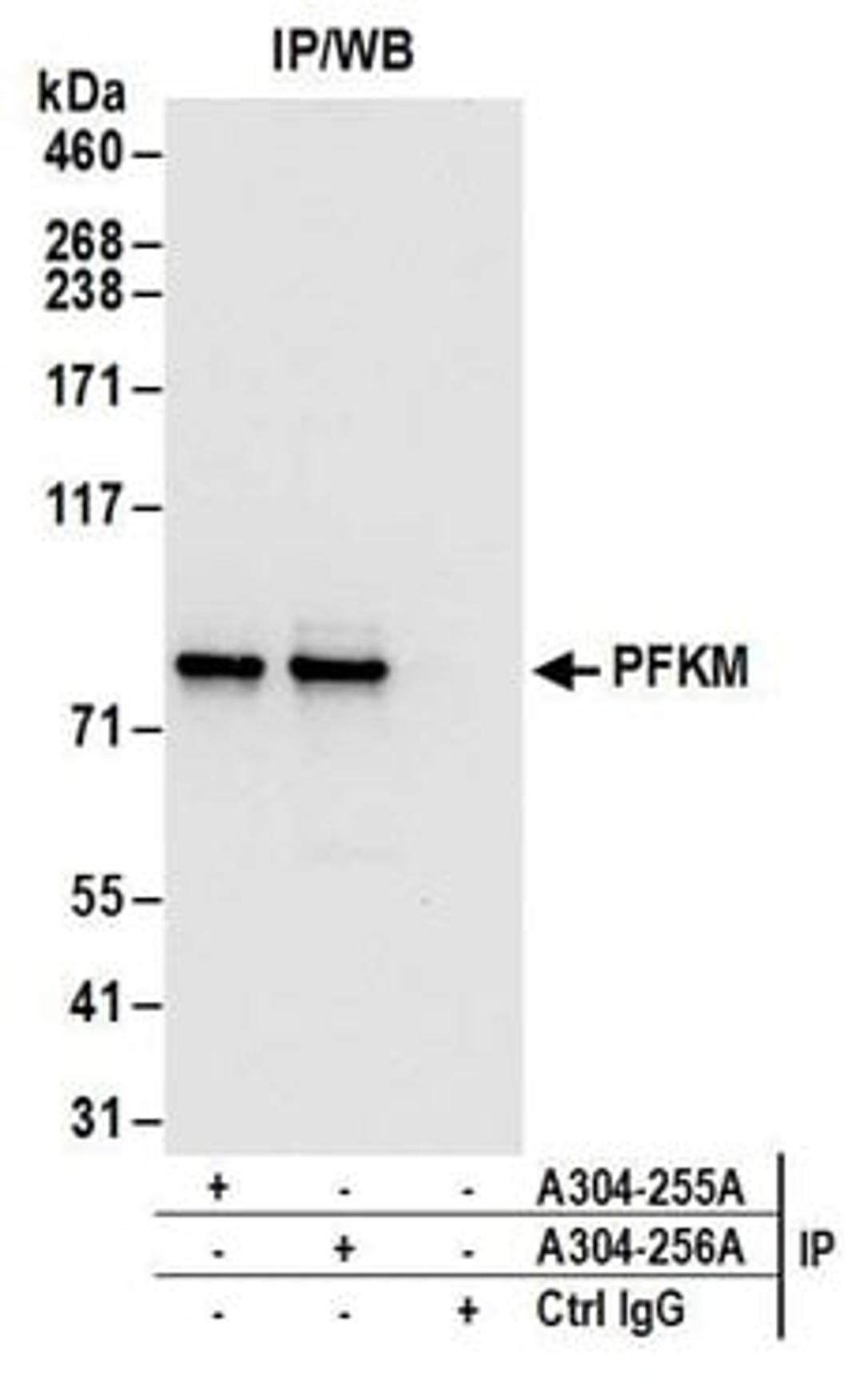 Detection of human PFKM by western blot of immunoprecipitates.