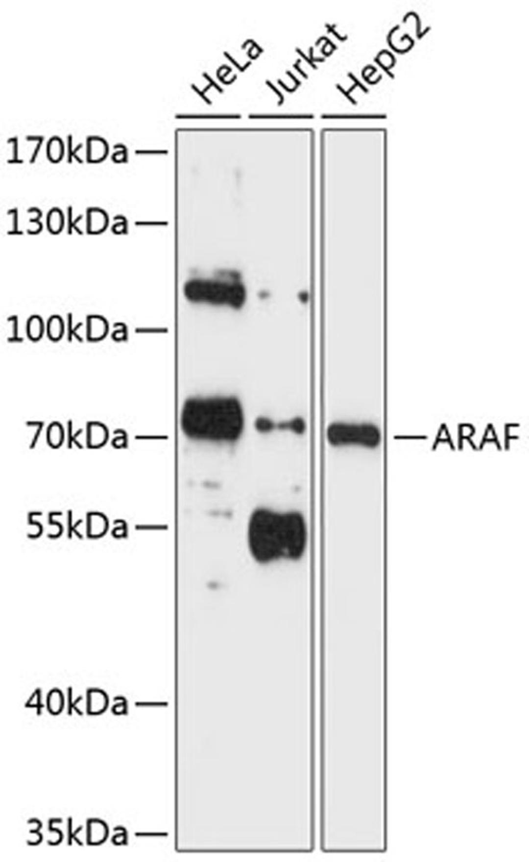 Western blot - ARAF antibody (A0180)