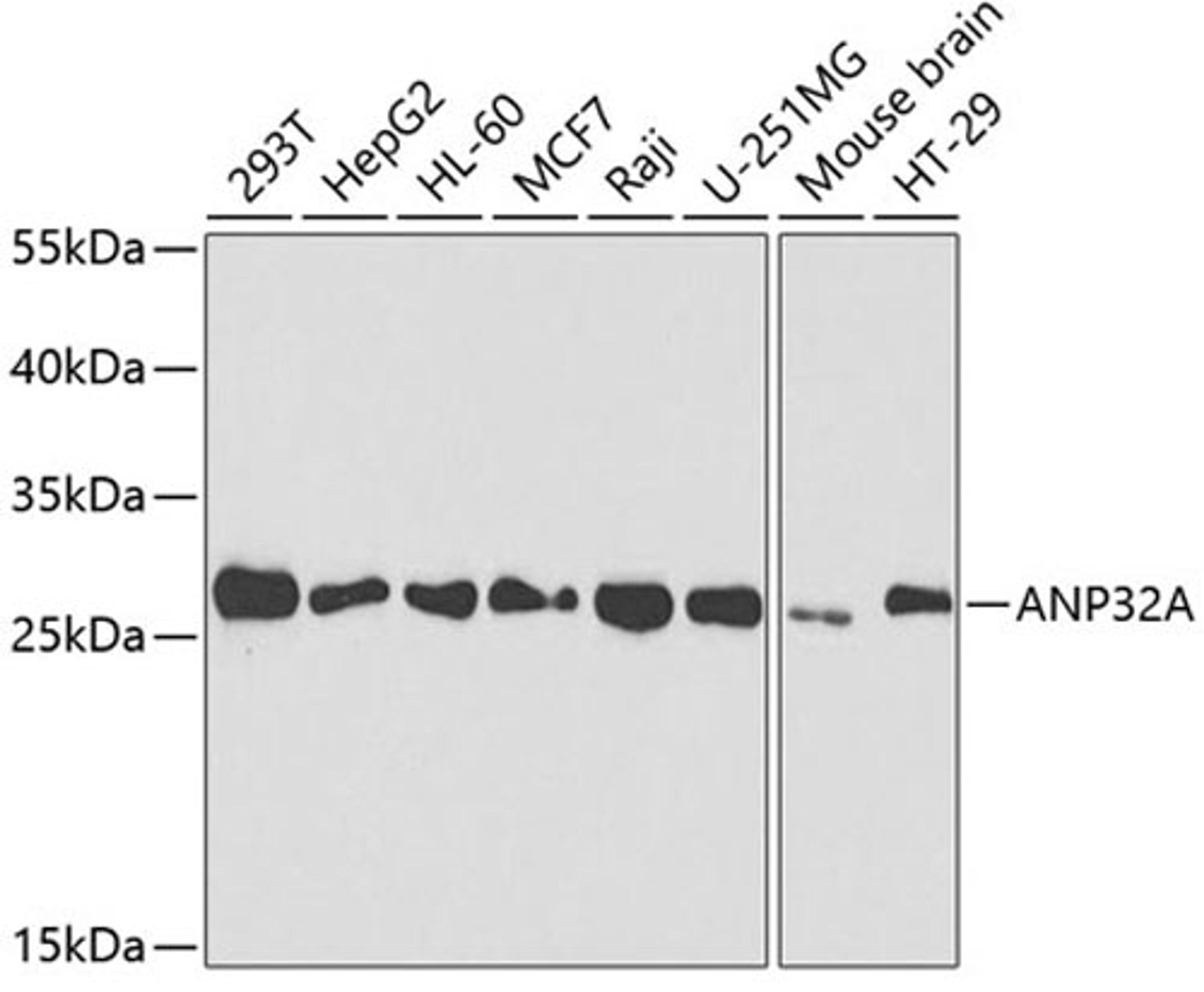 Western blot - ANP32A antibody (A5768)