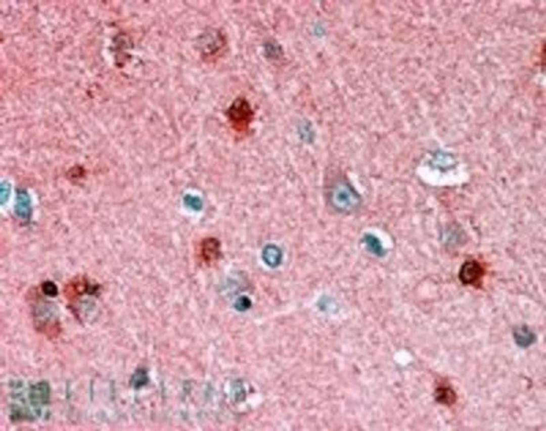 Immunohistochemistry: PBP Antibody [NB100-1020] - (1.5ug/ml) staining of paraffin embedded Human Cortex. Steamed antigen retrieval with citrate buffer pH 6, AP-staining.