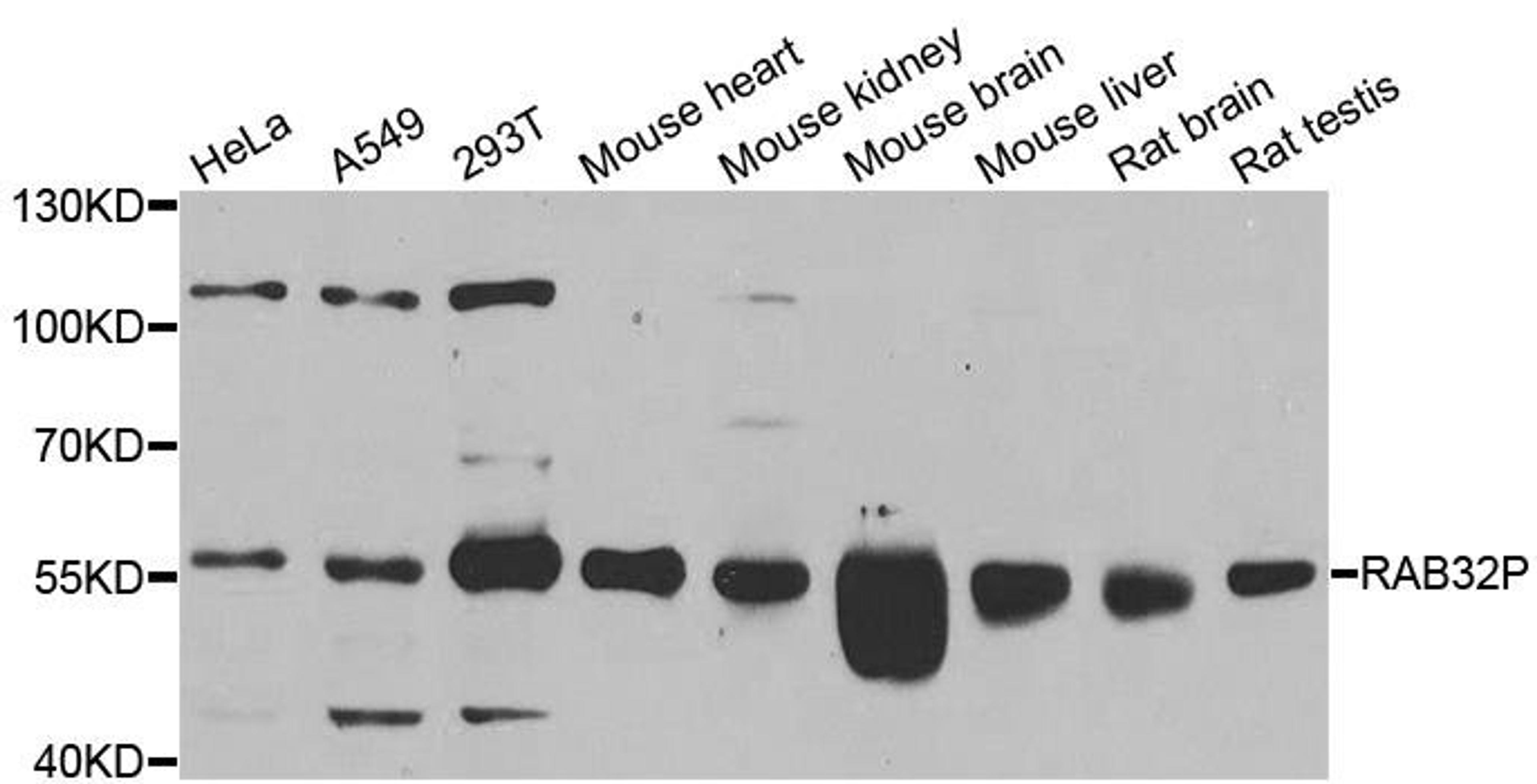 Western blot analysis of extracts of various cell lines using RAB3IP antibody