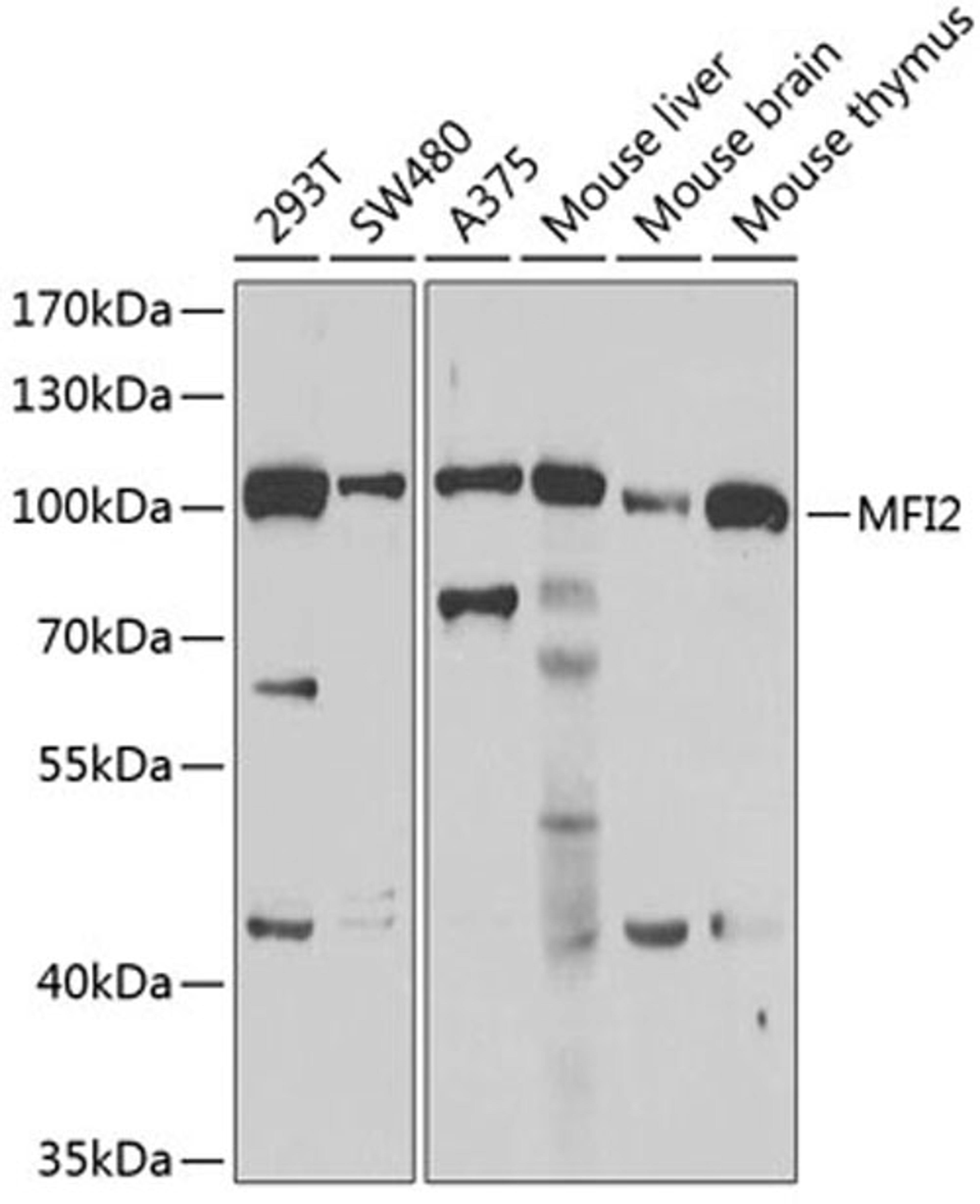 Western blot - MFI2 antibody (A6653)