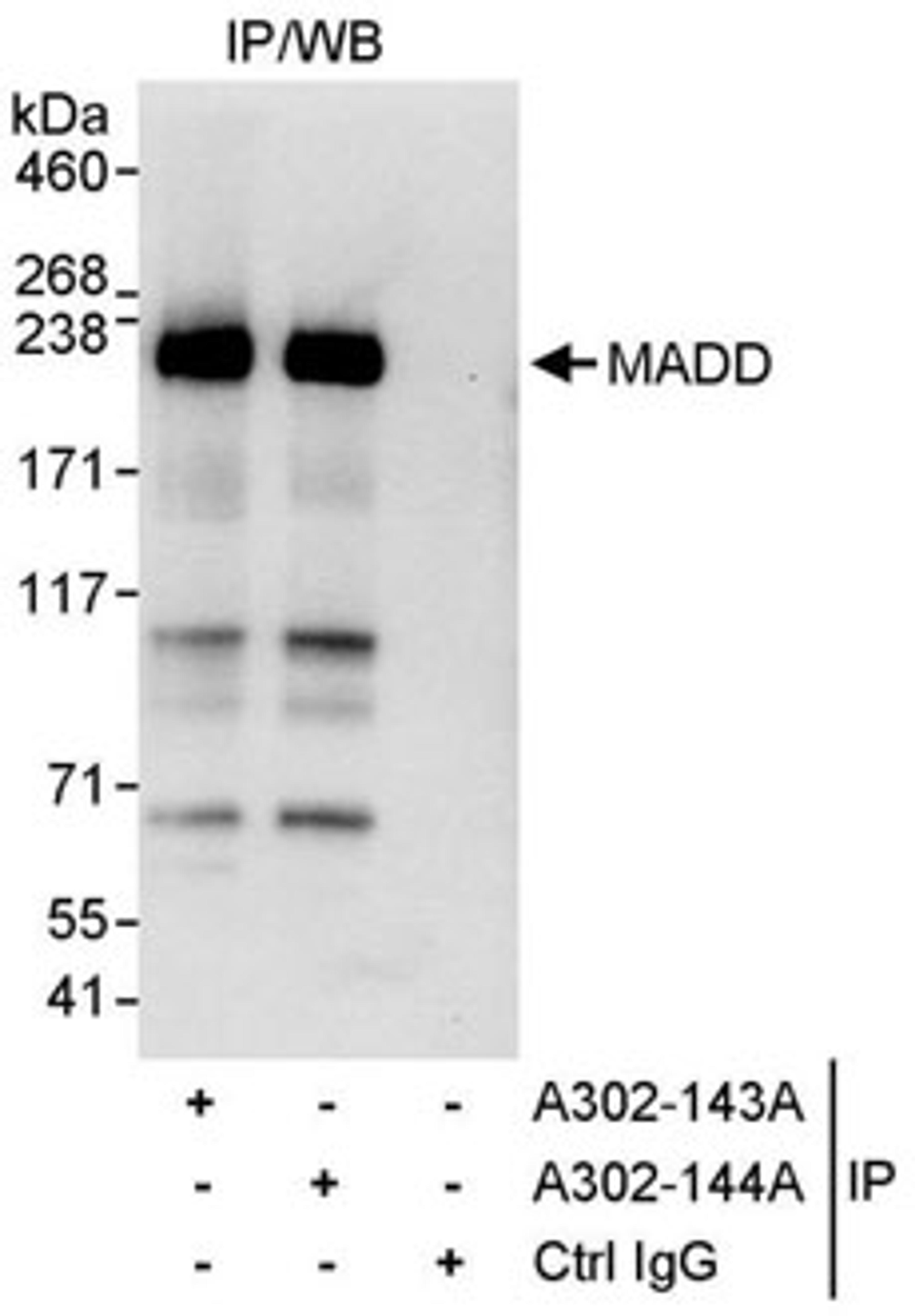 Detection of human MADD by western blot of immunoprecipitates.