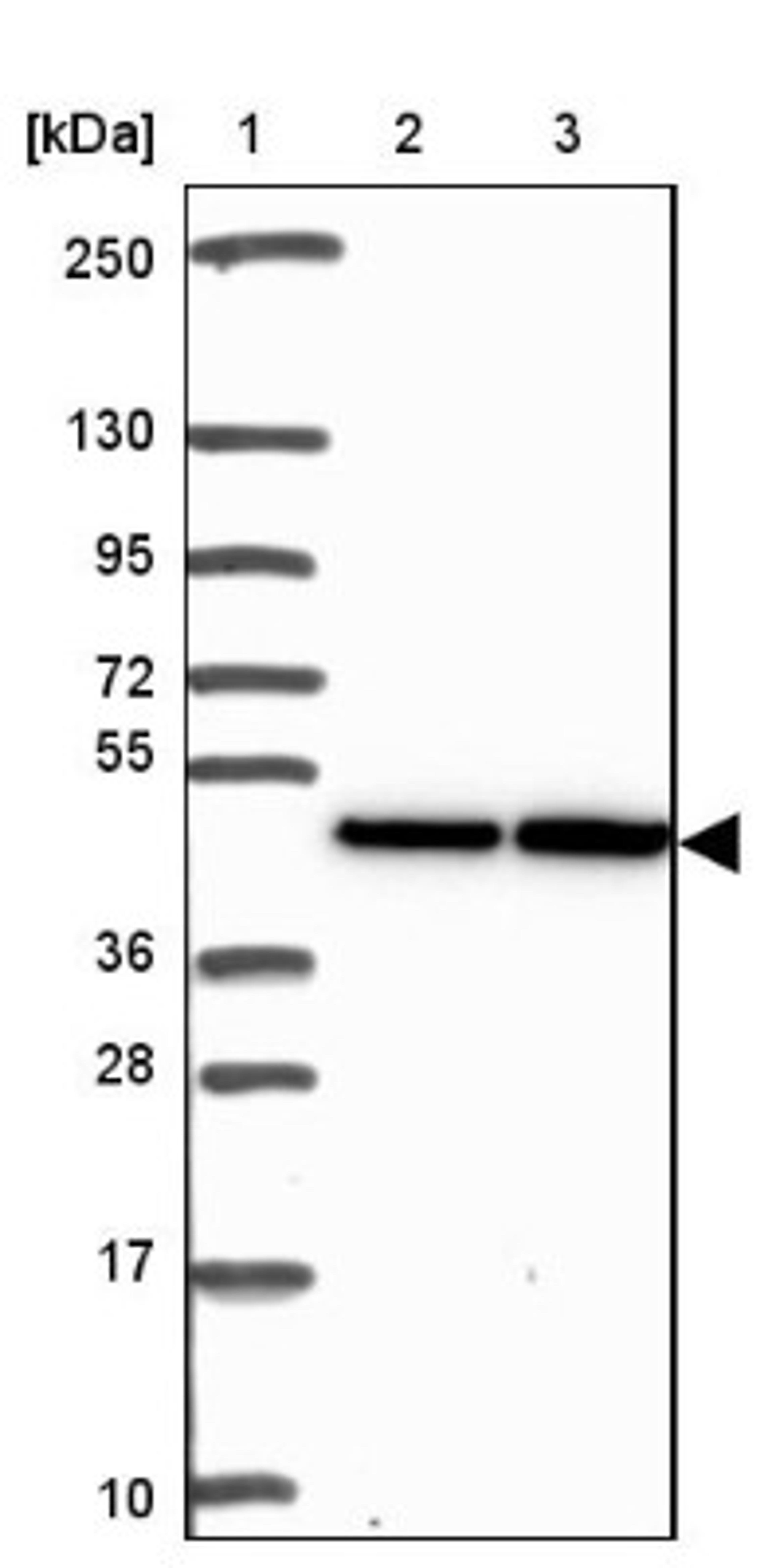 Western Blot: SEPN1 Antibody [NBP2-34098] - Lane 1: Marker [kDa] 250, 130, 95, 72, 55, 36, 28, 17, 10<br/>Lane 2: Human cell line RT-4<br/>Lane 3: Human cell line U-251MG sp