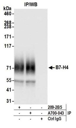 Detection of human B7-H4 by western blot of immunoprecipitates.