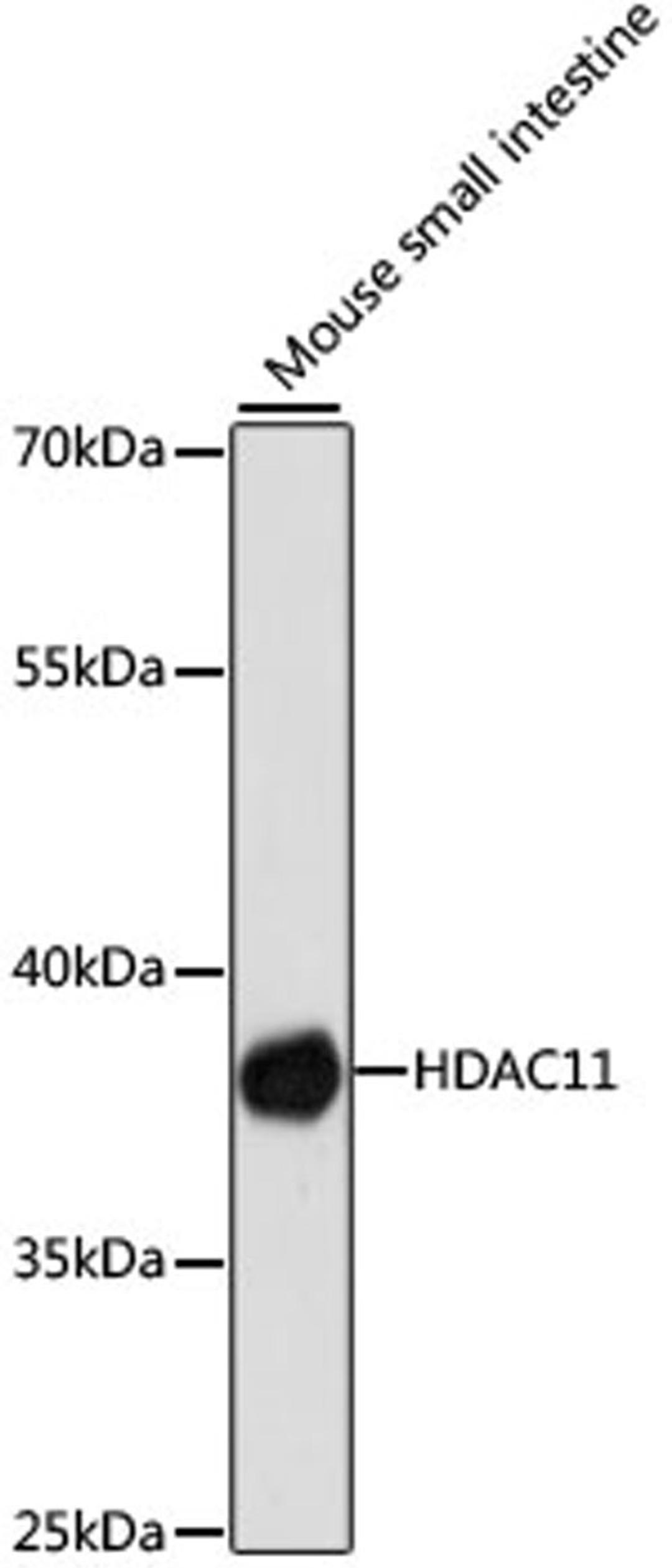 Western blot - HDAC11 antibody (A6140)