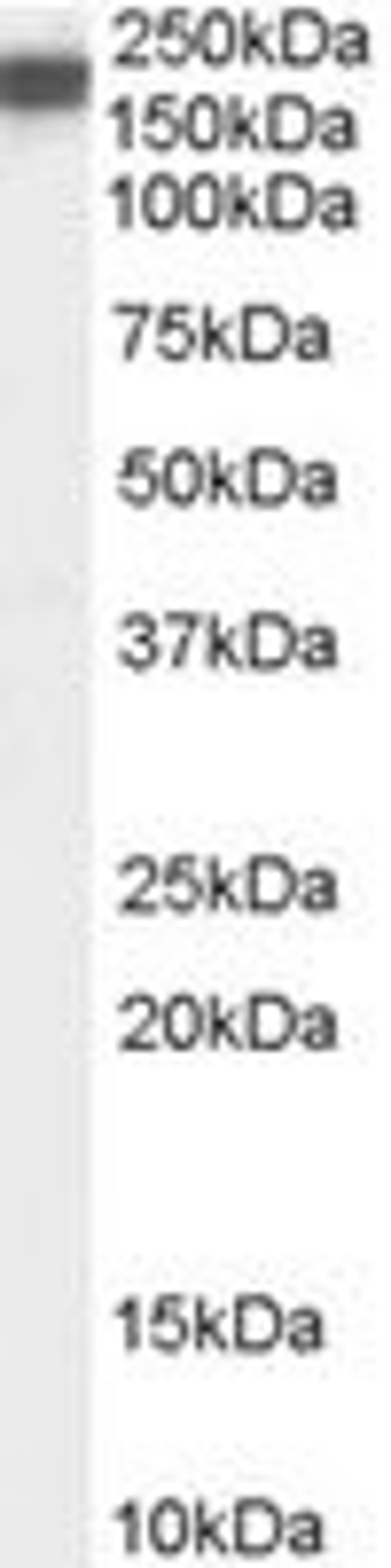 Western Blot: nNOS Antibody [NB100-858] - Western blot analysis of nNOS in human muscle extracts (RIPA buffer, 35ug total protein per lane) using NB100-858 at 0.3 ug/ml.