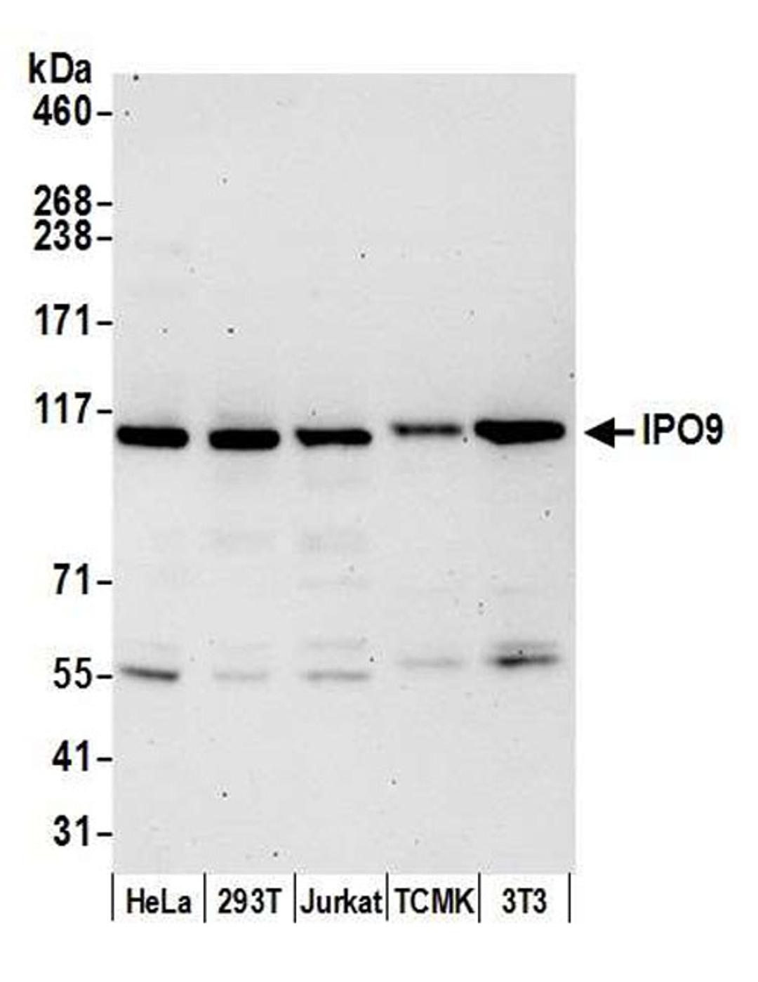 Detection of human and mouse IPO9 by WB.