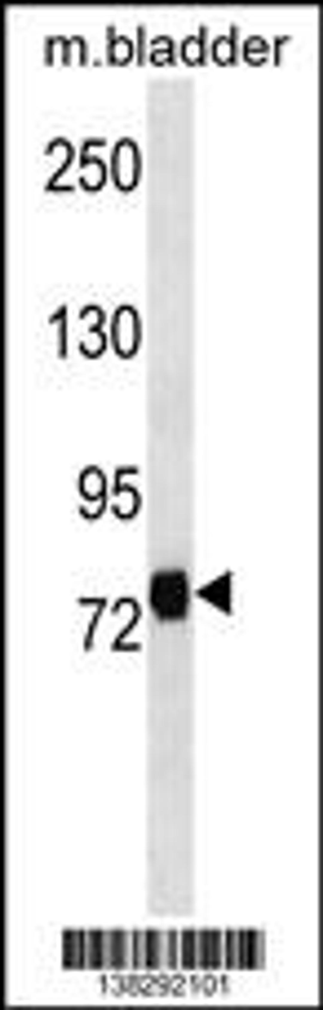 Western blot analysis in mouse bladder tissue lysates (35ug/lane).