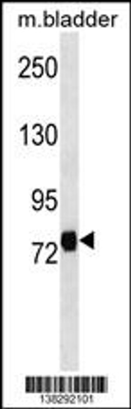 Western blot analysis in mouse bladder tissue lysates (35ug/lane).