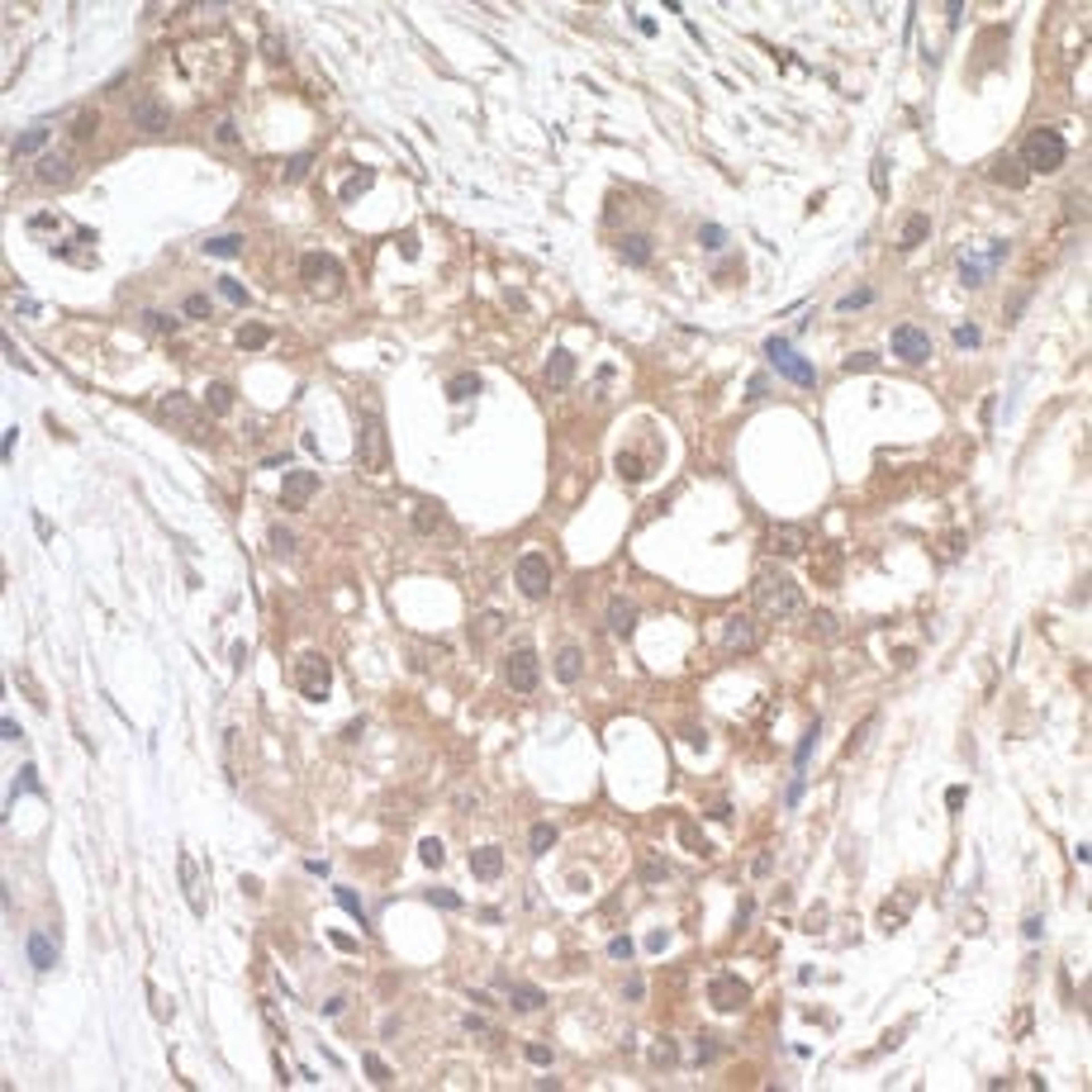 Detection of human PTPIP51 by immunohistochemistry.