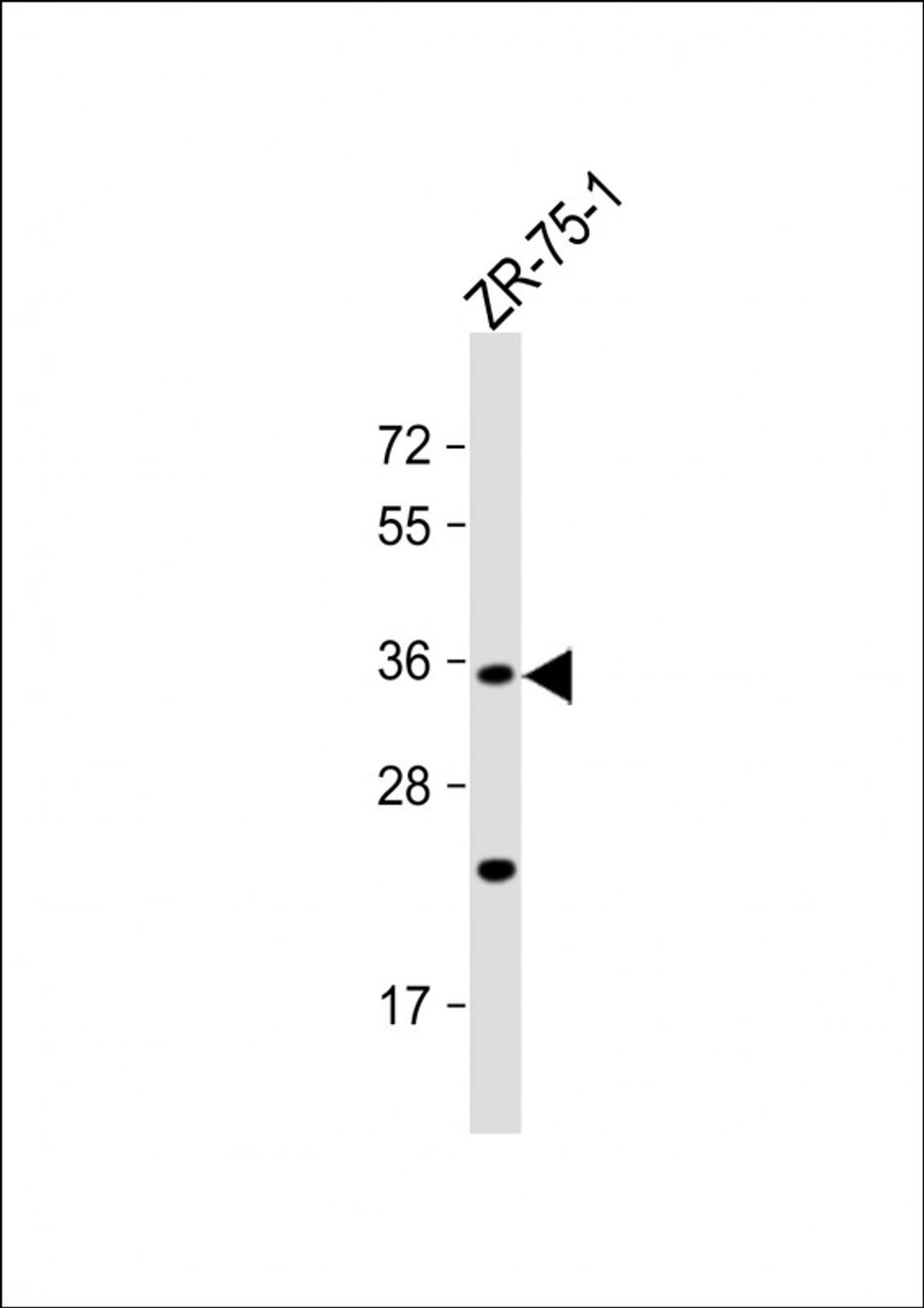 Western Blot at 1:1000 dilution + ZR-75-1 whole cell lysate Lysates/proteins at 20 ug per lane.