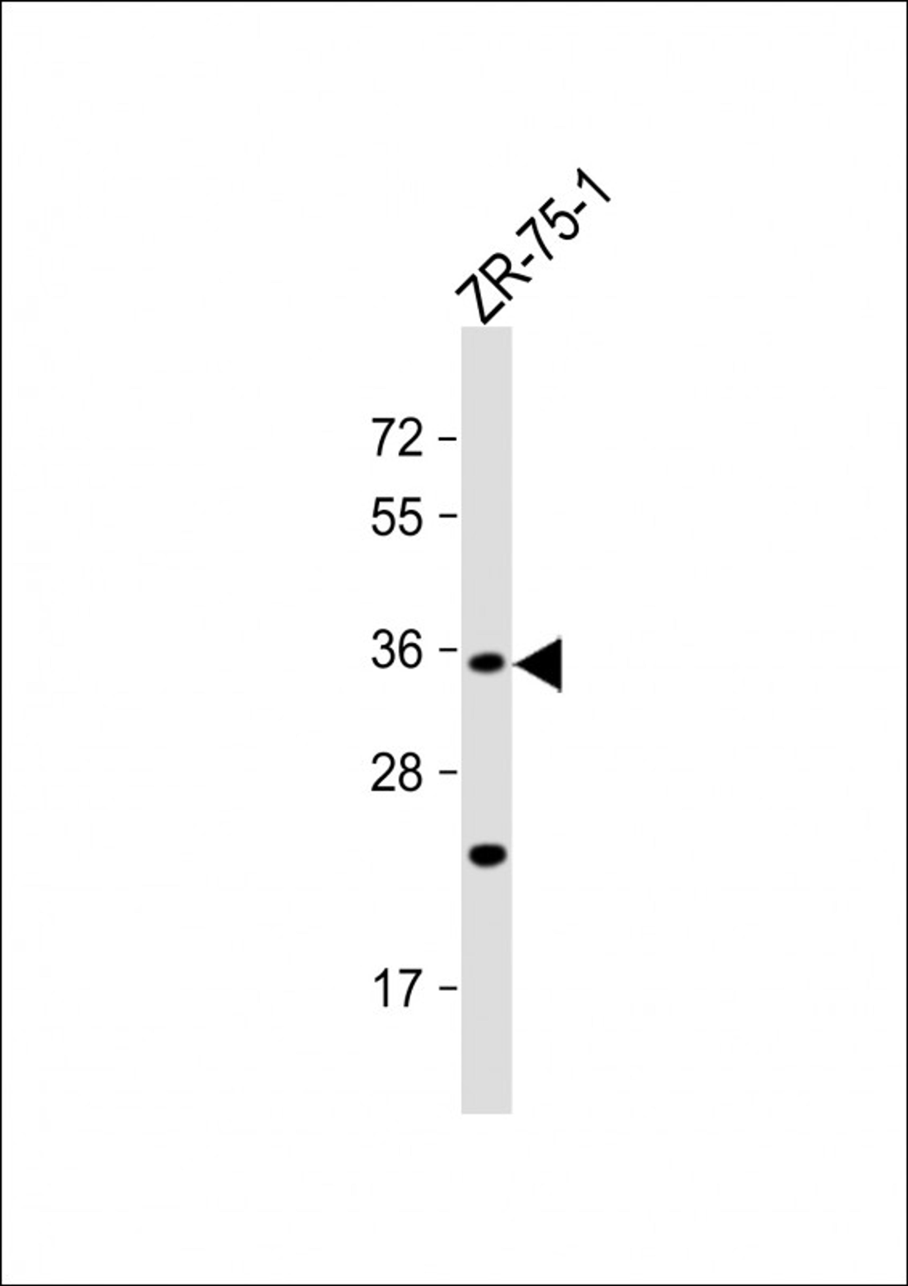 Western Blot at 1:1000 dilution + ZR-75-1 whole cell lysate Lysates/proteins at 20 ug per lane.