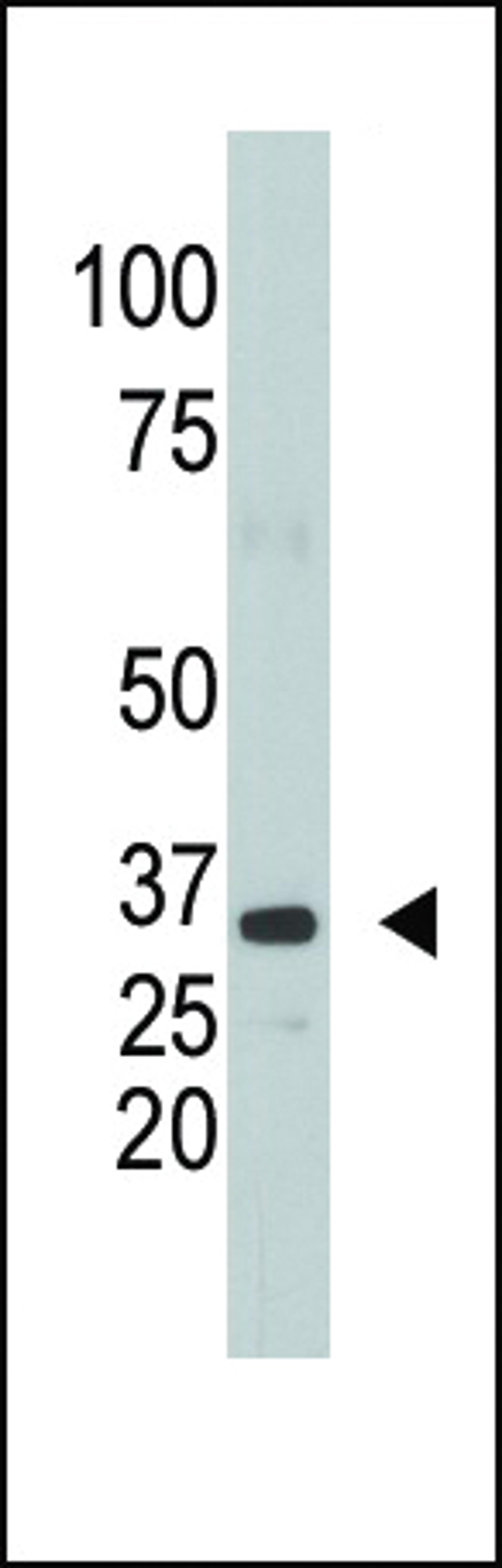 Antibody is used in Western blot to detect SULT1A1 in mouse kidney tissue lysate.