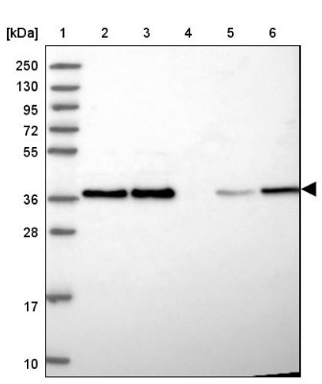 Western Blot: HDGF Antibody [NBP2-38589] - Lane 1: Marker [kDa] 250, 130, 95, 72, 55, 36, 28, 17, 10<br/>Lane 2: RT-4<br/>Lane 3: U-251 MG<br/>Lane 4: Human Plasma<br/>Lane 5: Liver<br/>Lane 6: Tonsil