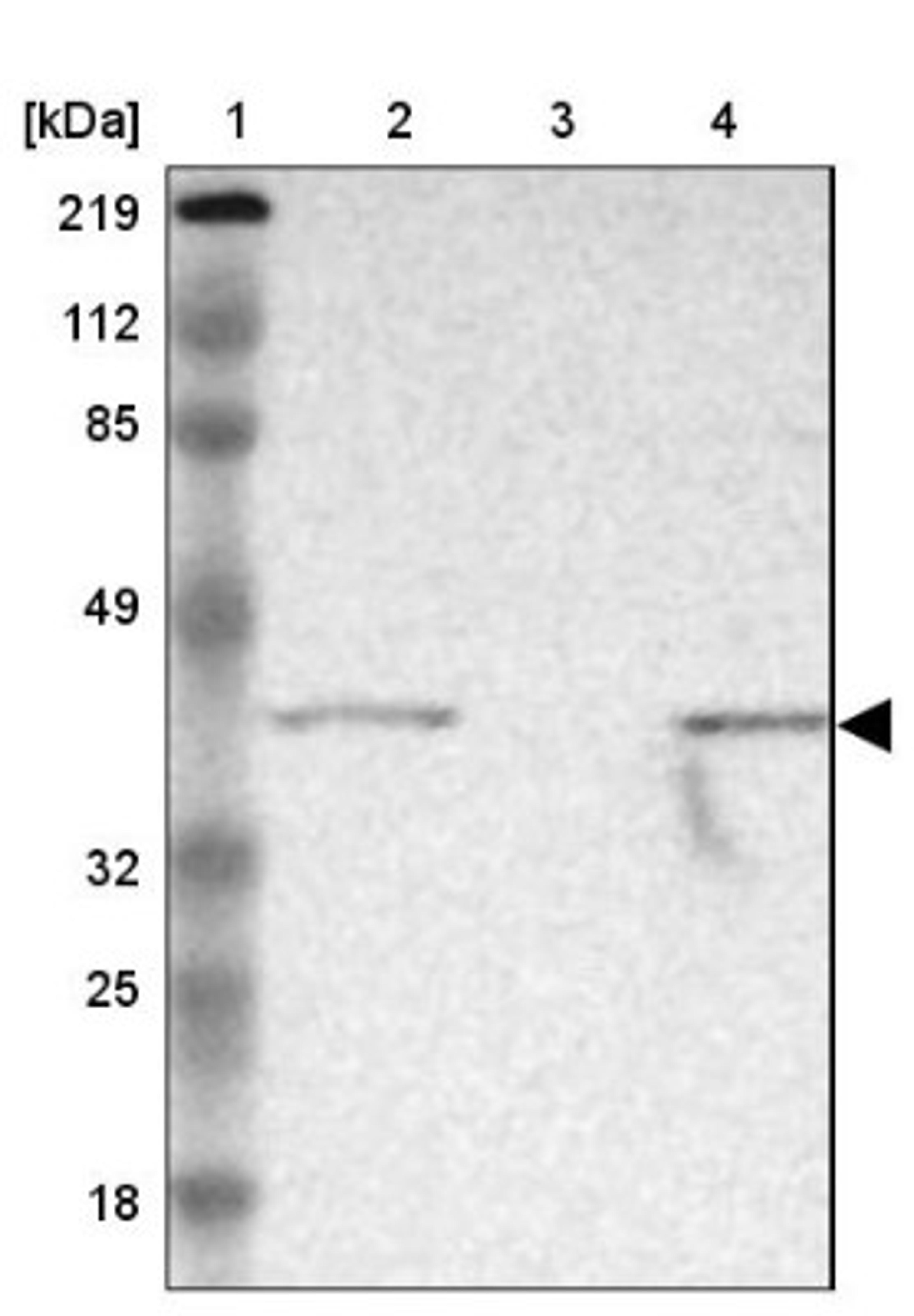 Western Blot: ARMCX3 Antibody [NBP1-89142] - Lane 1: Marker [kDa] 219, 112, 85, 49, 32, 25, 18<br/>Lane 2: Human cell line RT-4<br/>Lane 3: Human cell line U-251MG sp<br/>Lane 4: Human cell line A-431