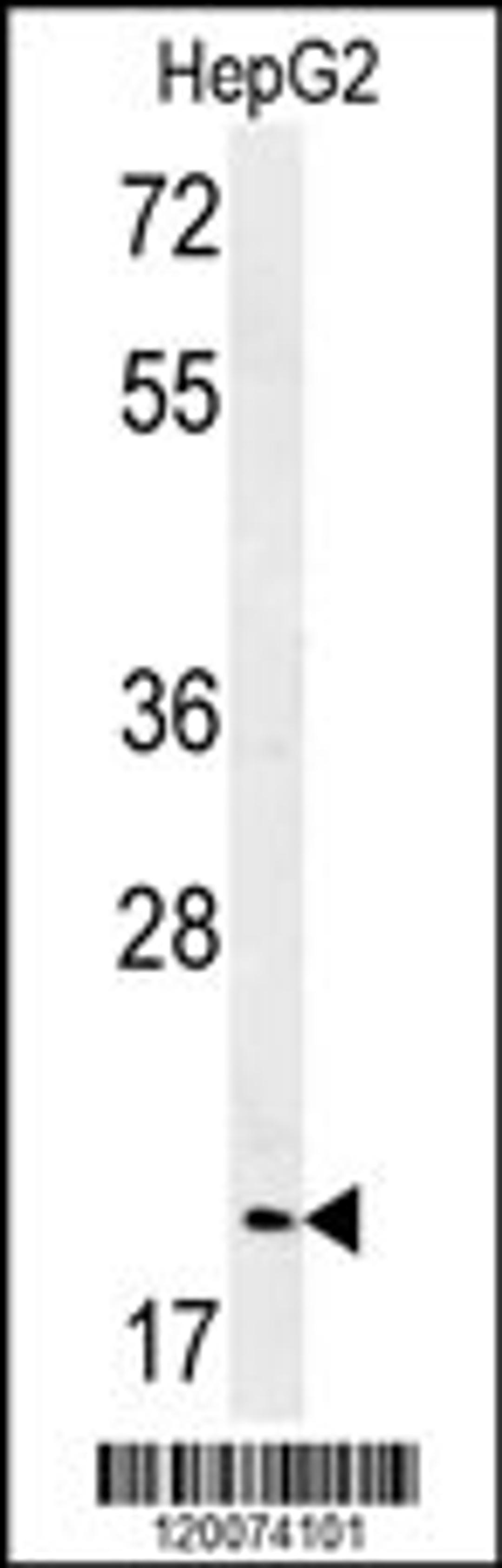 Western blot analysis of in HepG2 cell line lysates (35ug/lane)