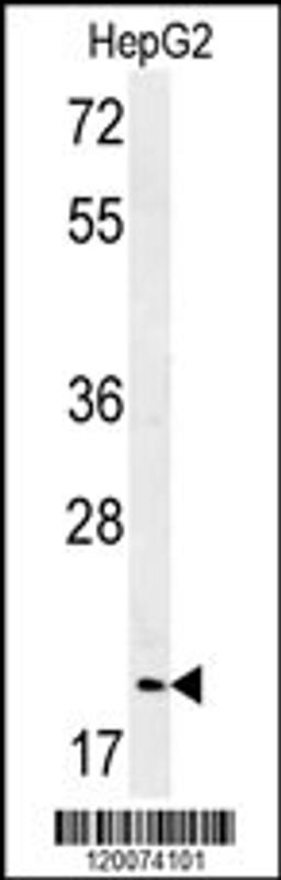 Western blot analysis of in HepG2 cell line lysates (35ug/lane)