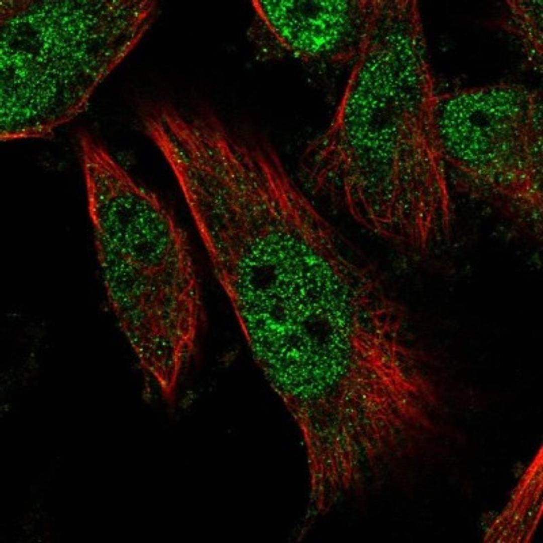 Immunocytochemistry/Immunofluorescence: LRRC27 Antibody [NBP1-81383] - Staining of human cell line U-251 MG shows positivity in nucleus but not nucleoli.