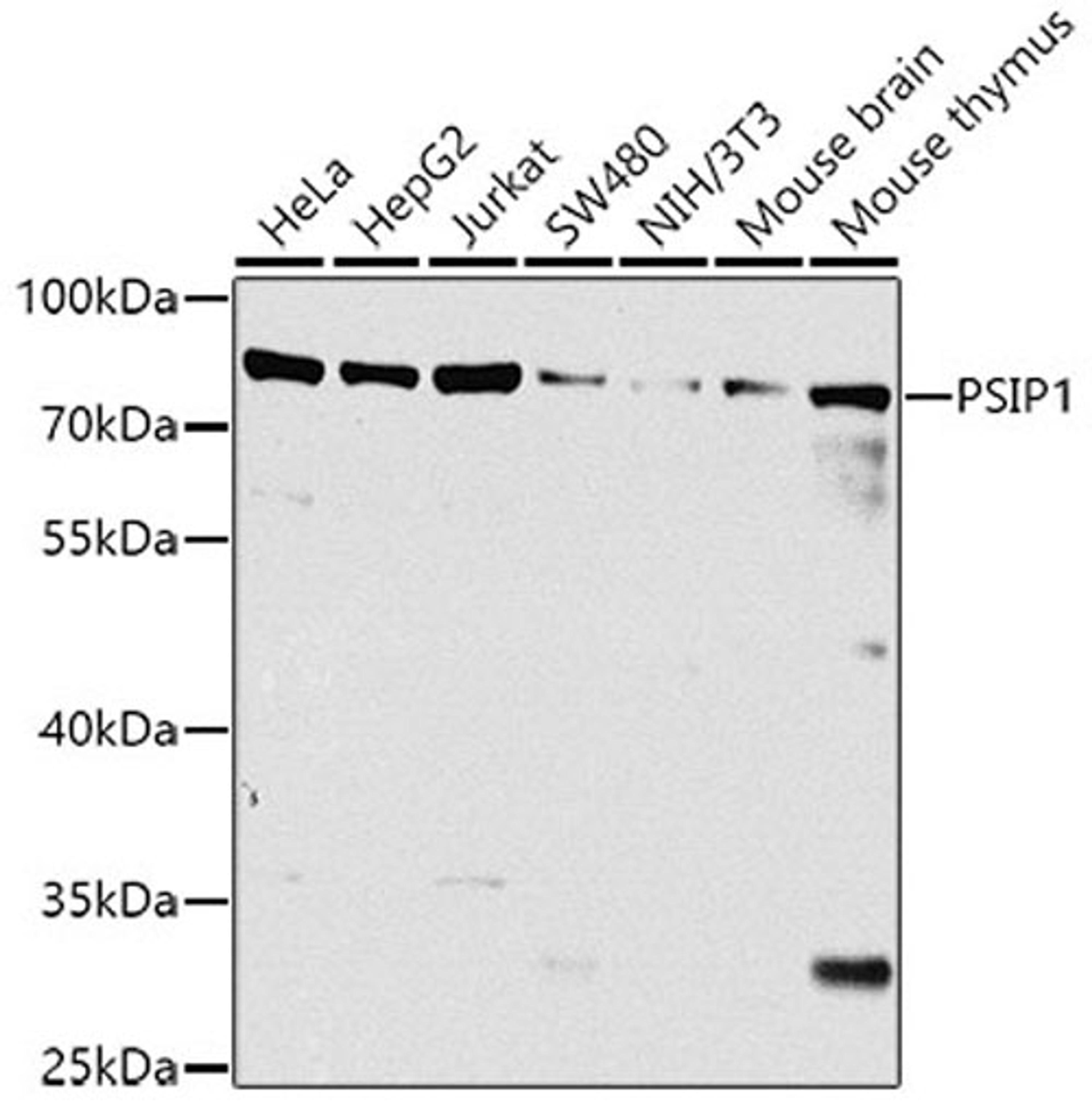 Western blot - PSIP1 antibody (A8483)