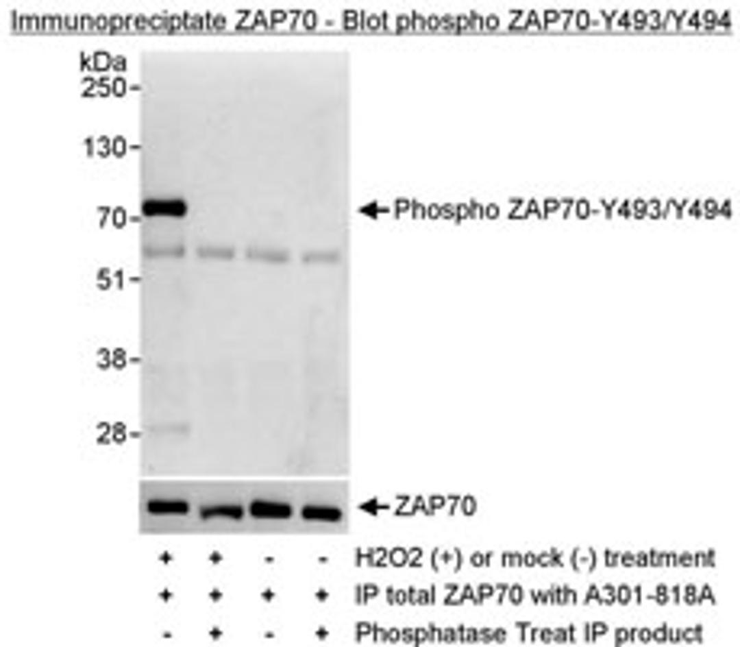 Detection of Phosphorylation of human ZAP70 on Y493/Y494 by western blot of immunoprecipitates.