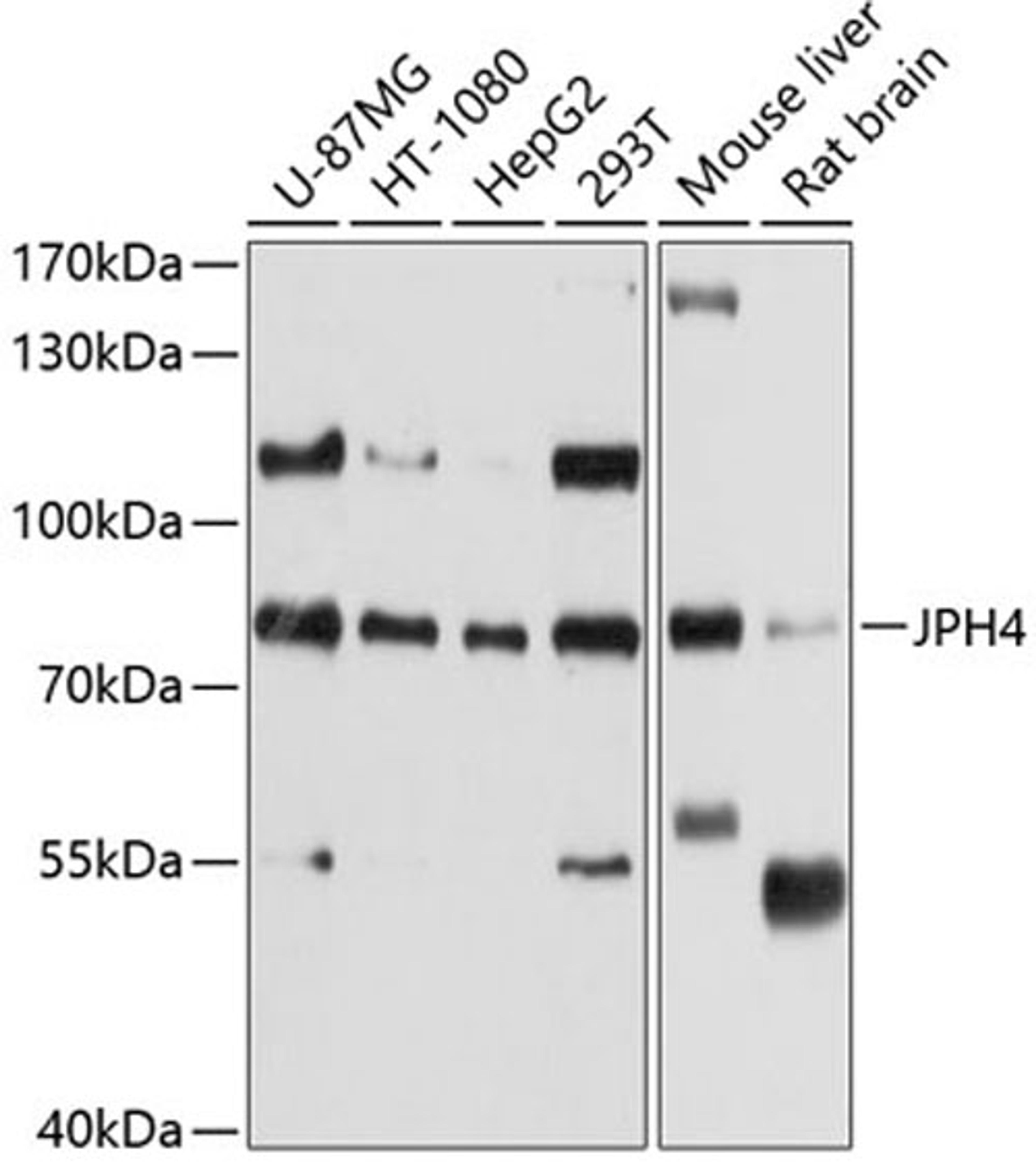 Western blot - JPH4 antibody (A10333)