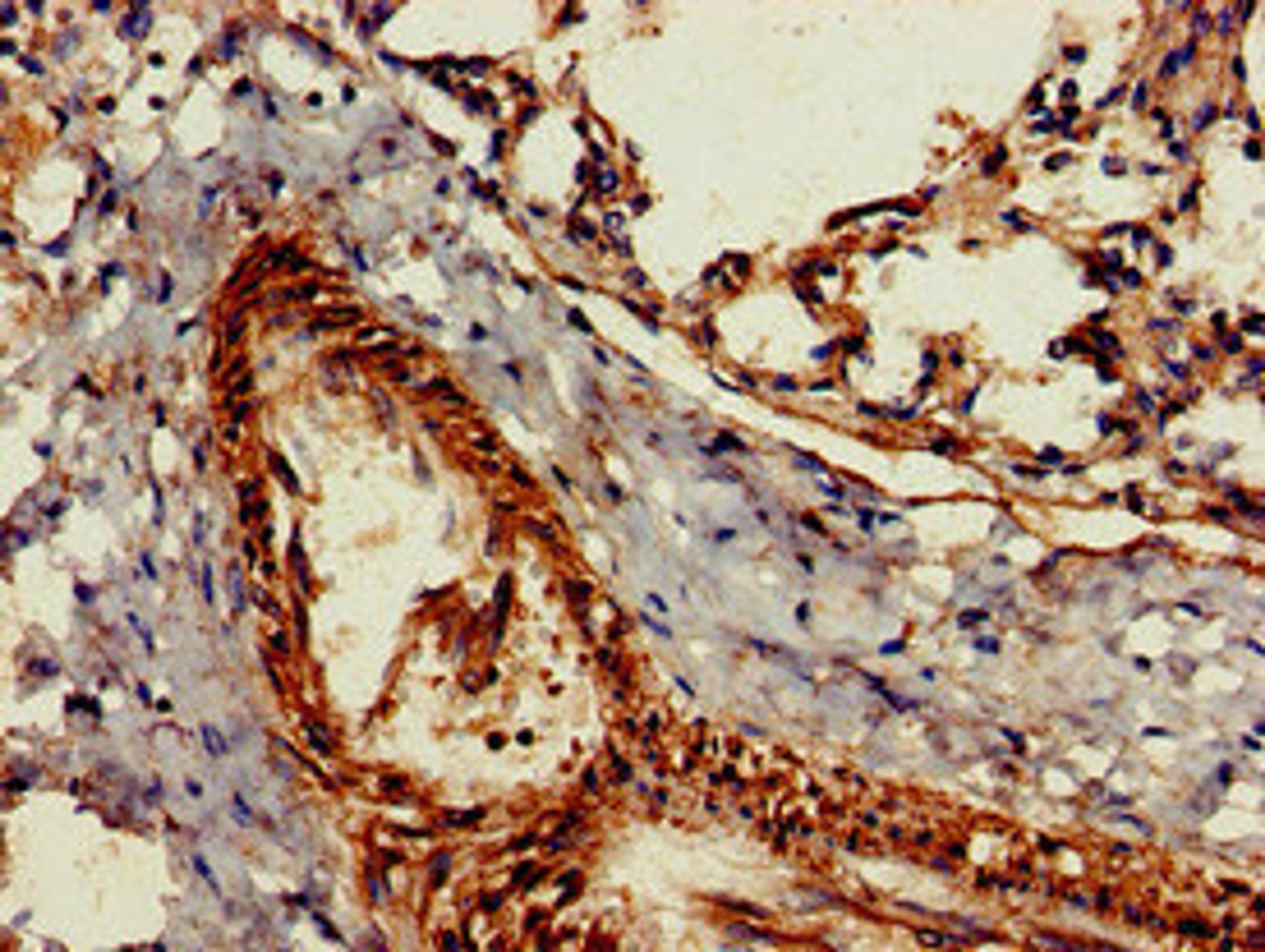Immunohistochemistry of paraffin-embedded human lung tissue using CSB-PA010084LA01HU at dilution of 1:100