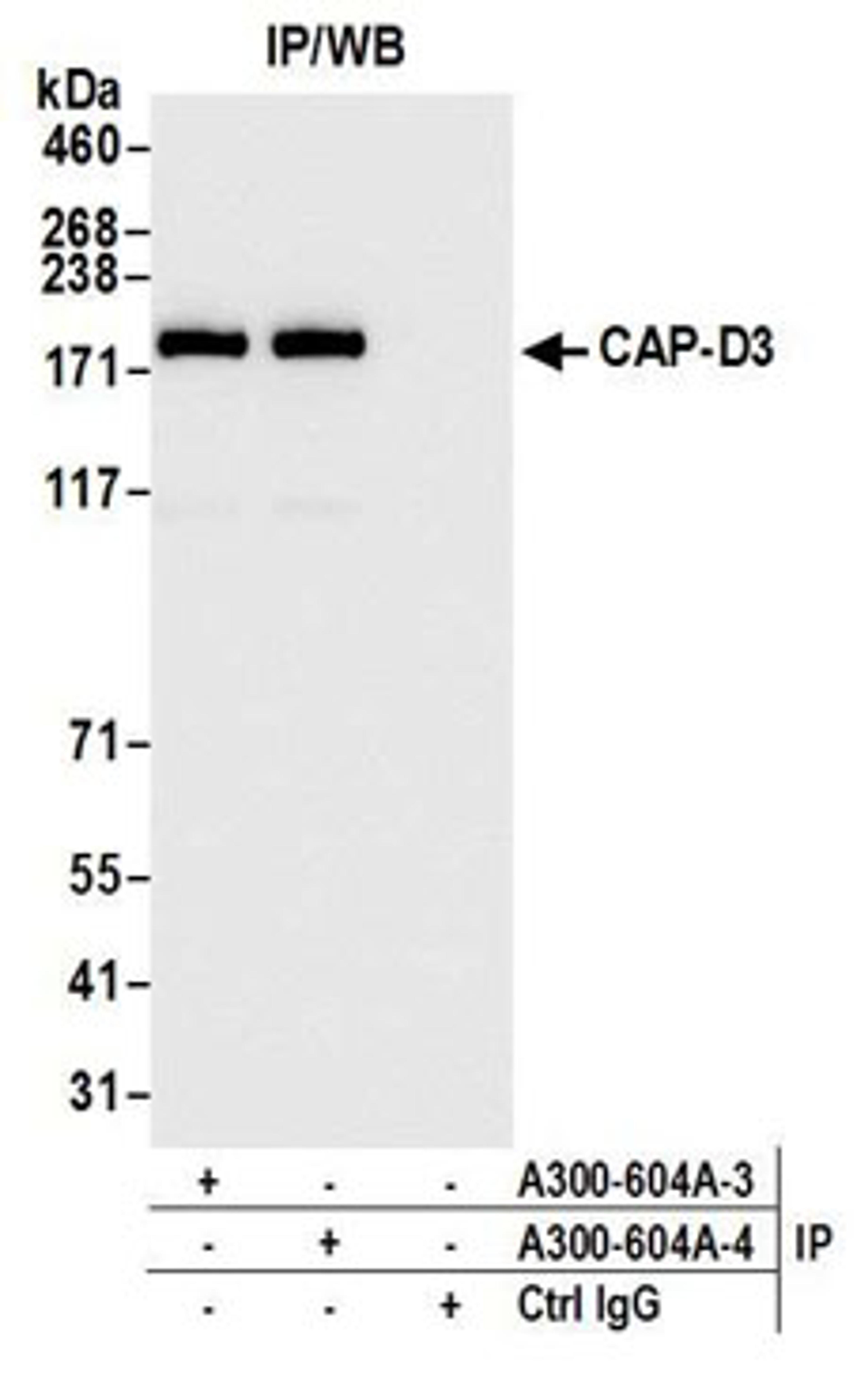 Detection of human CAP-D3 by western blot of immunoprecipitates.