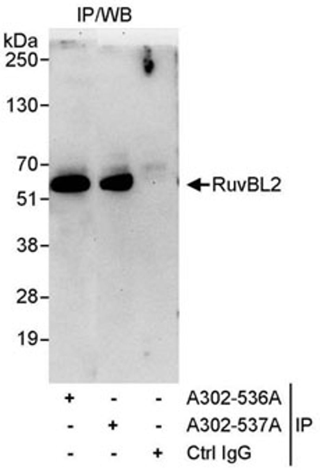 Detection of human RuvBL2 by western blot of immunoprecipitates.