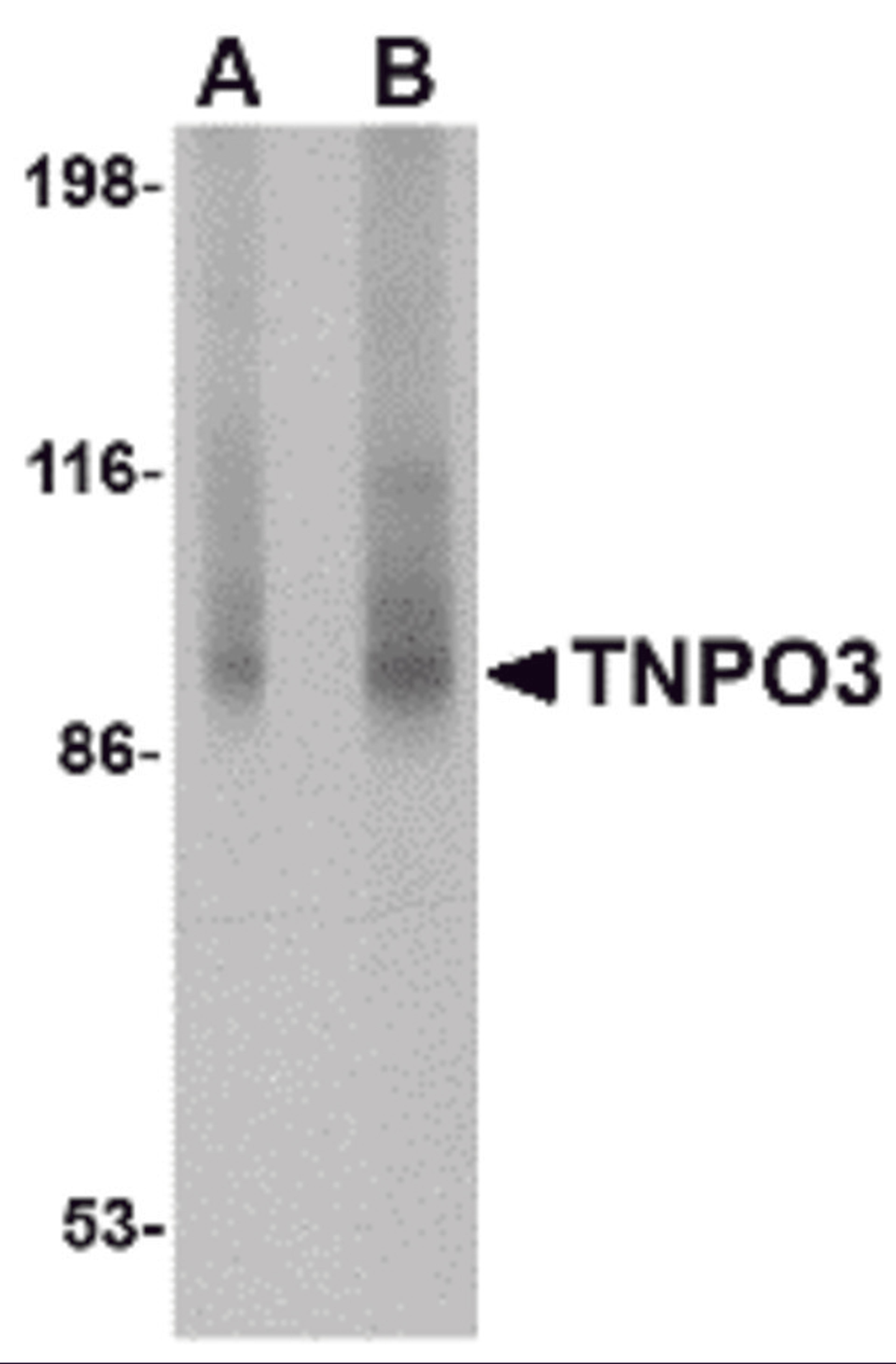 Western blot analysis of TNPO3 in rat liver tissue lysate with TNPO3 antibody at (A) 1 and (B) 2 &#956;g/mL.