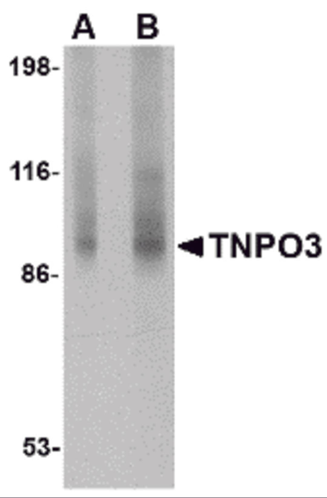 Western blot analysis of TNPO3 in rat liver tissue lysate with TNPO3 antibody at (A) 1 and (B) 2 μg/mL.