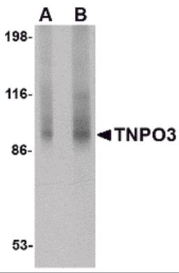 Western blot analysis of TNPO3 in rat liver tissue lysate with TNPO3 antibody at (A) 1 and (B) 2 μg/mL.