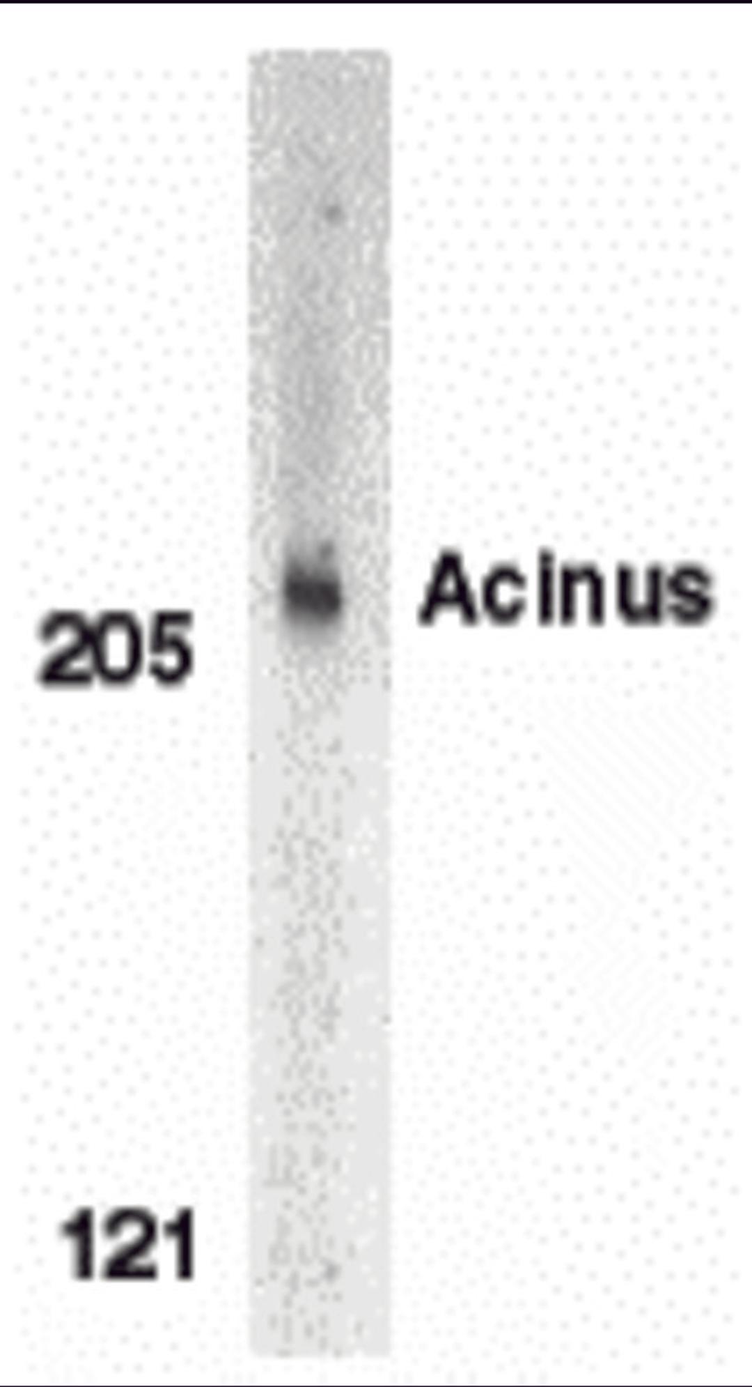 Western blot analysis of Acinus in K562 whole cell lysate with Acinus antibody (CP) at 1 μg/mL.