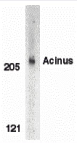 Western blot analysis of Acinus in K562 whole cell lysate with Acinus antibody (CP) at 1 μg/mL.