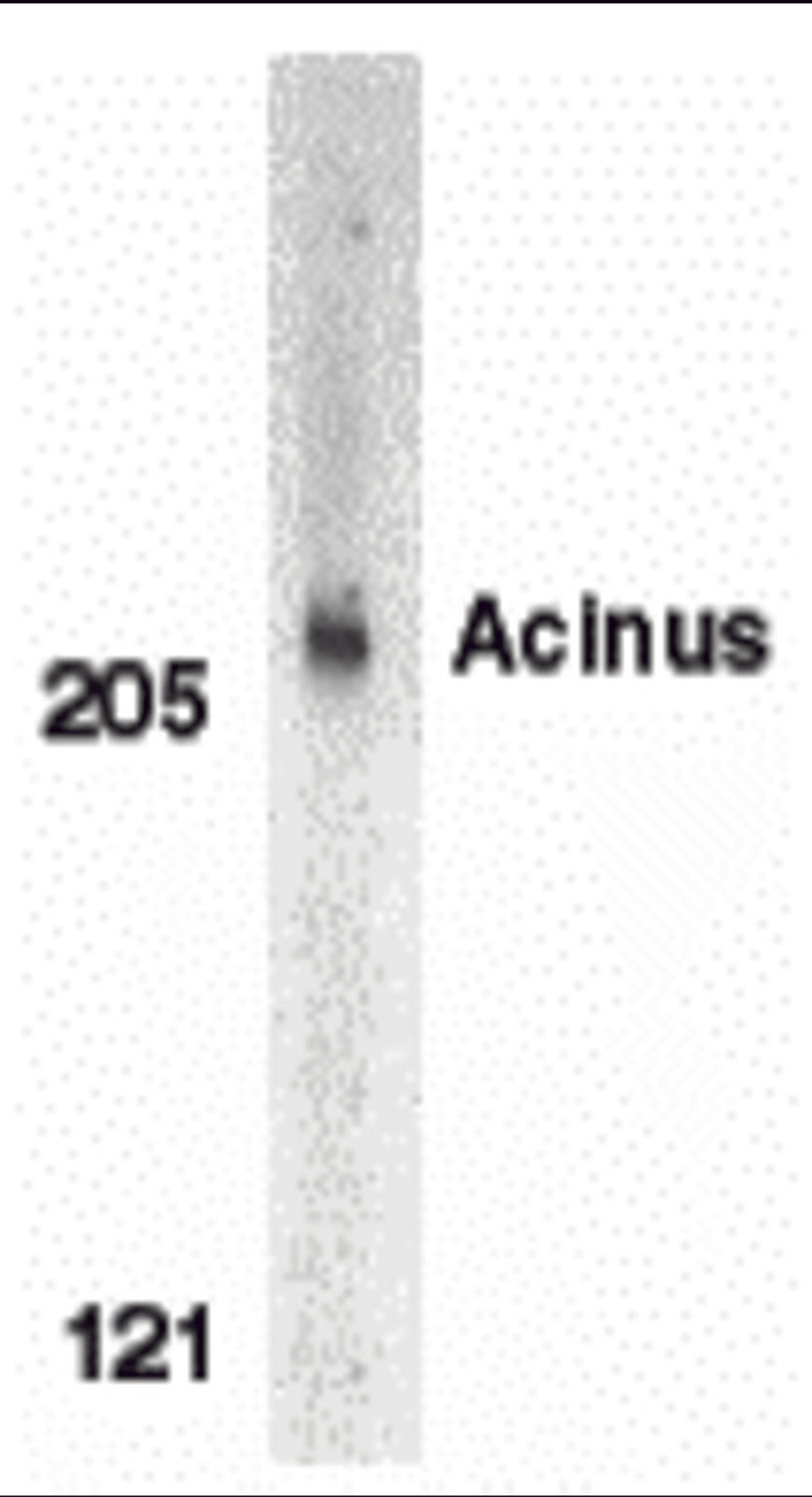 Western blot analysis of Acinus in K562 whole cell lysate with Acinus antibody (CP) at 1 μg/mL.