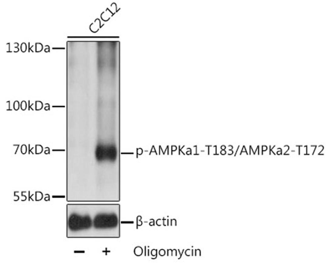 Western blot - Phospho-AMPKa1-T183/AMPKa2-T172 antibody (AP0432)