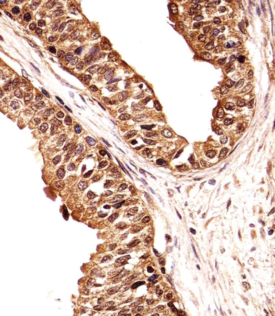 Immunohistochemical analysis of paraffin-embedded H. prostate section using ECE2 Antibody . Antibody was diluted at 1:25 dilution. A undiluted biotinylated goat polyvalent antibody was used as the secondary, followed by DAB staining.