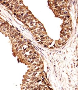 Immunohistochemical analysis of paraffin-embedded H. prostate section using ECE2 Antibody . Antibody was diluted at 1:25 dilution. A undiluted biotinylated goat polyvalent antibody was used as the secondary, followed by DAB staining.