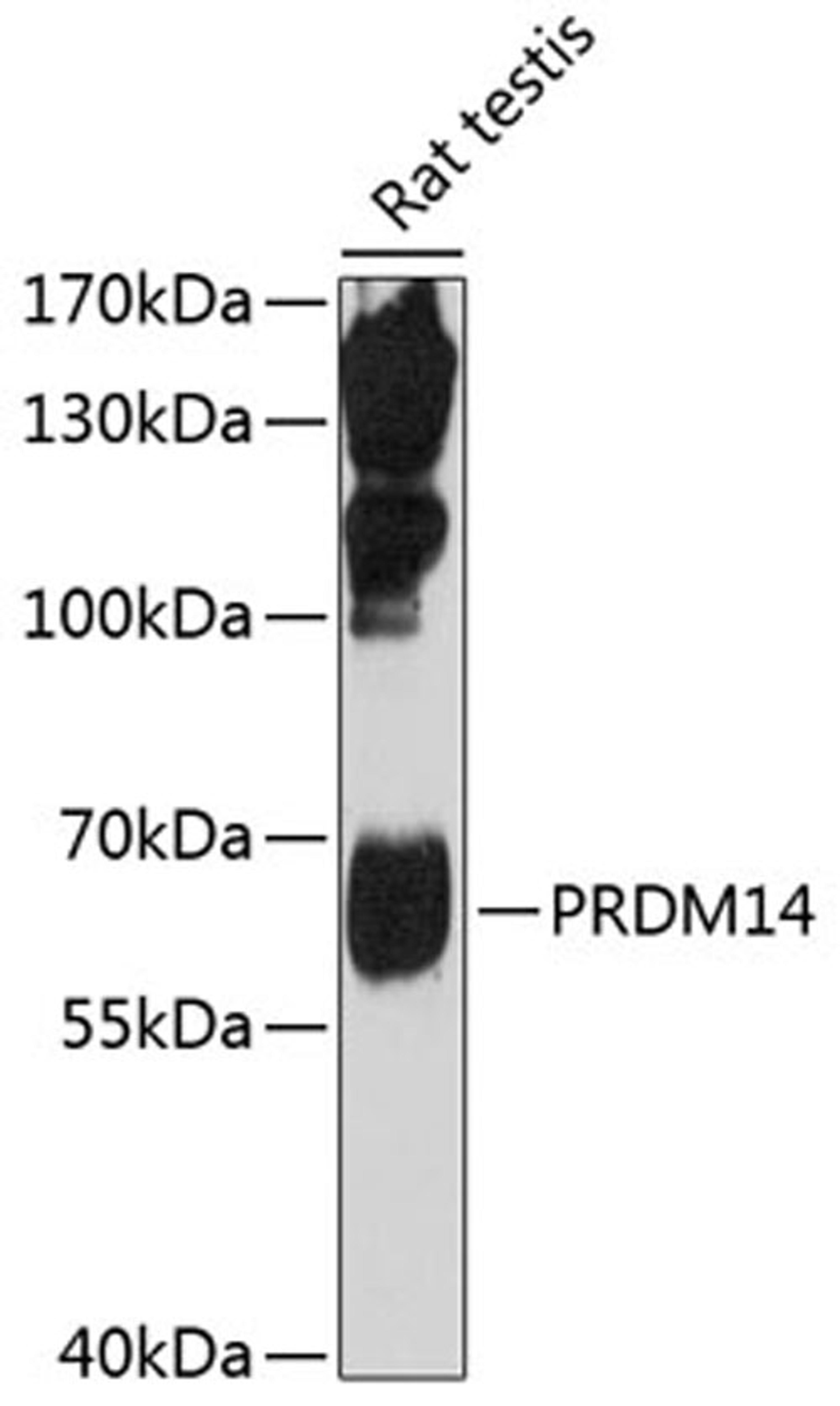 Western blot - PRDM14 antibody (A5543)