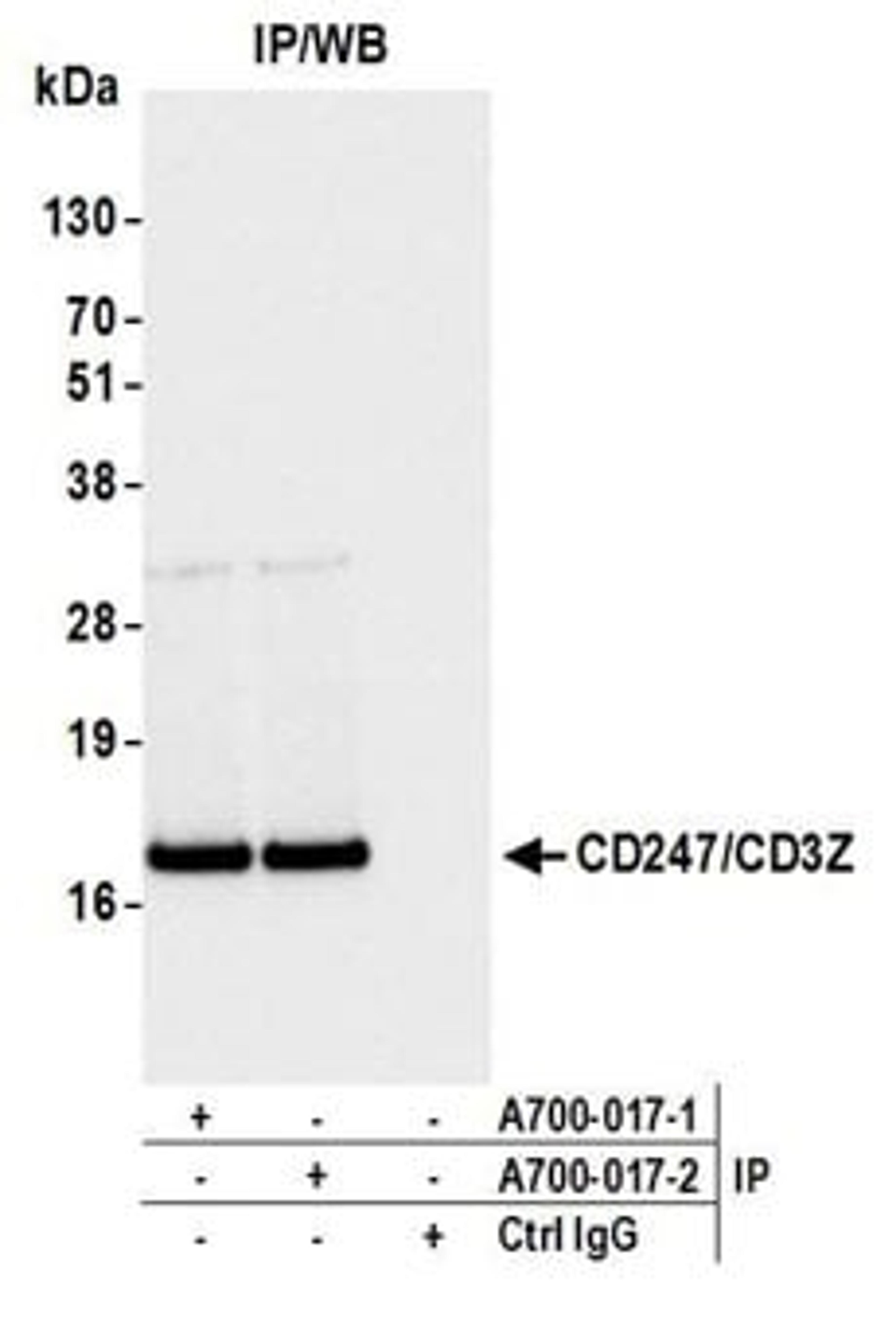 Detection of human CD247/CD3Z by western blot of immunoprecipitates.