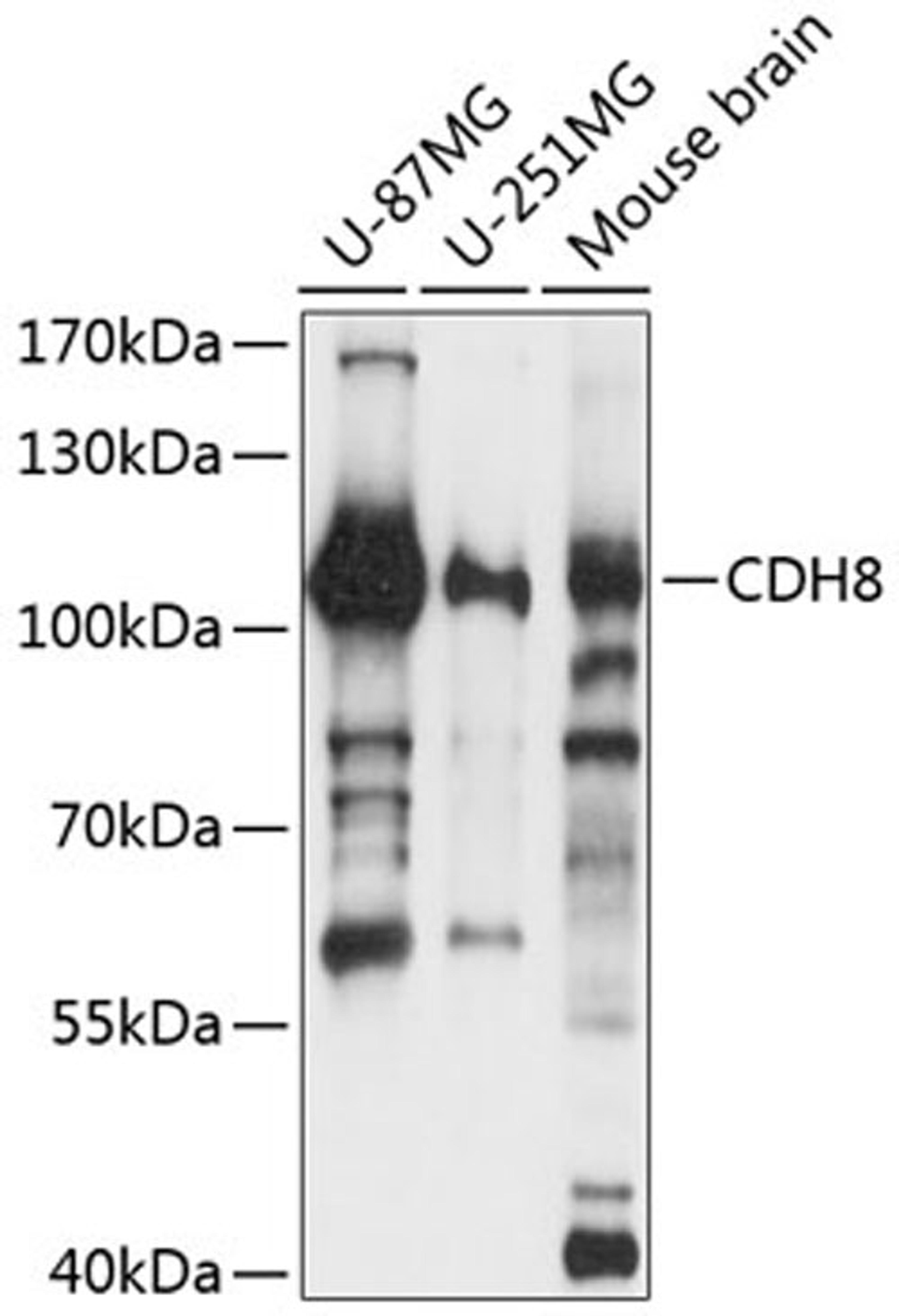 Western blot - CDH8 antibody (A14236)