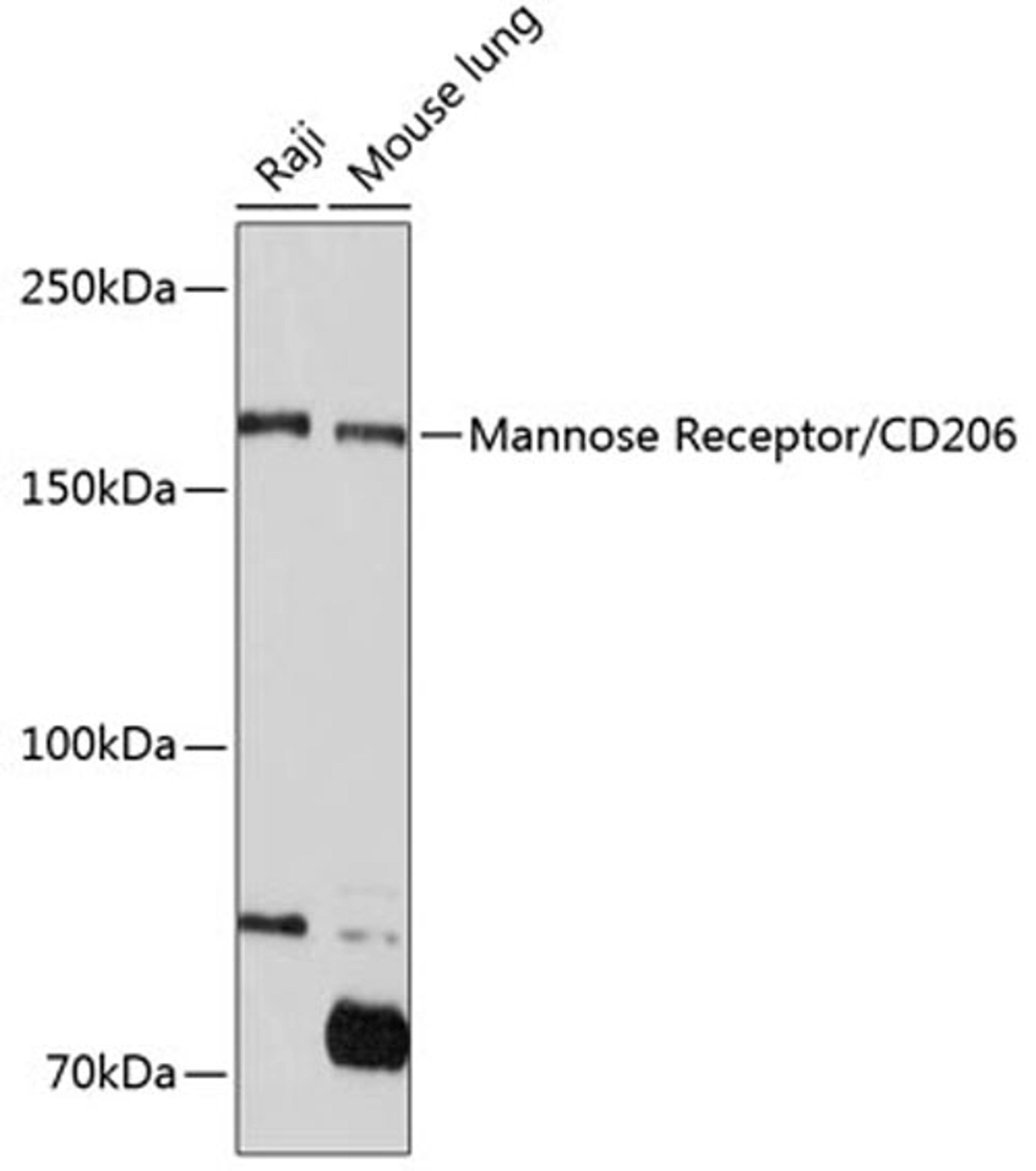 Western blot - Mannose Receptor/CD206 Rabbit mAb (A11192)