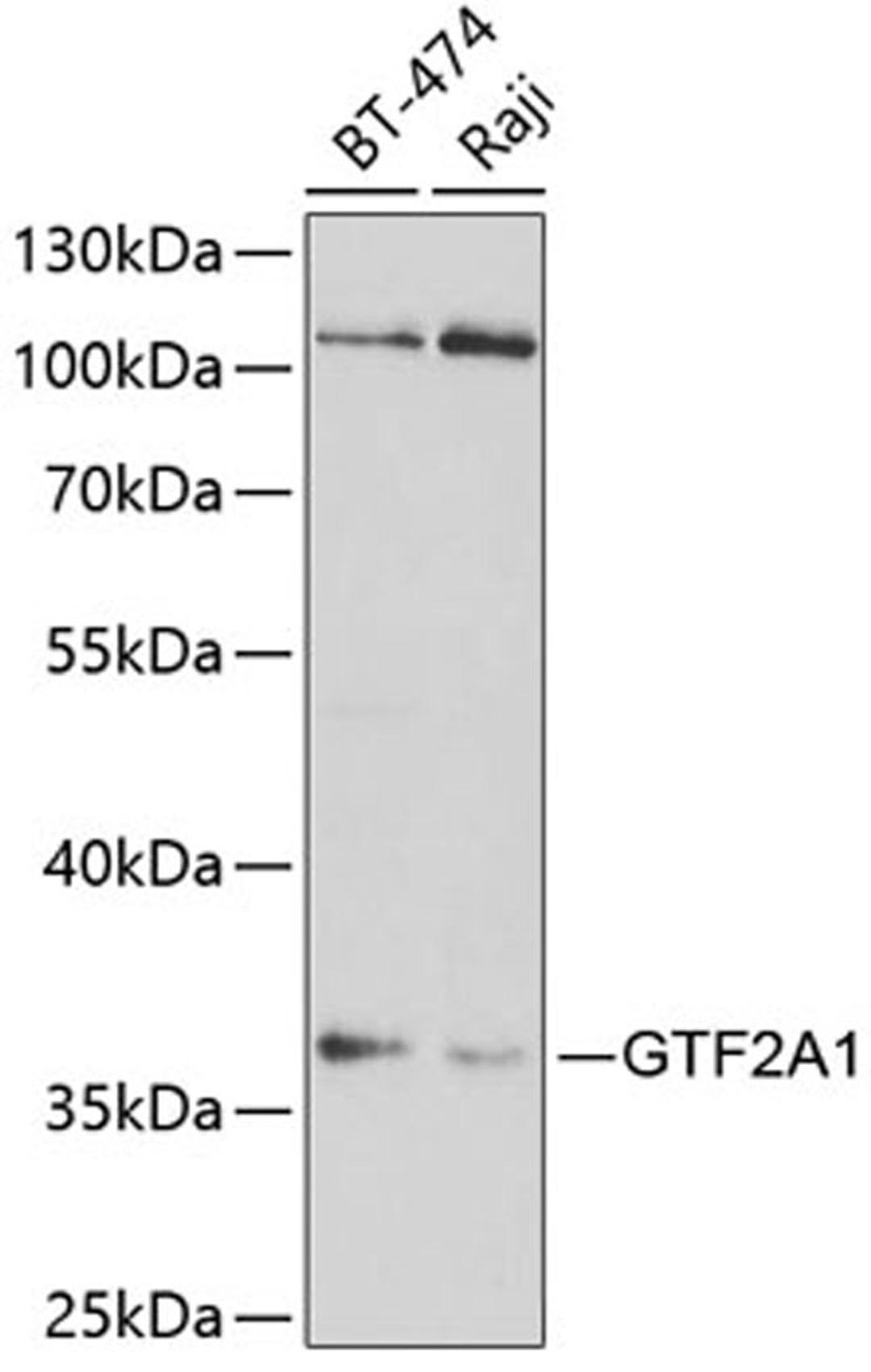 Western blot - GTF2A1 antibody (A5345)